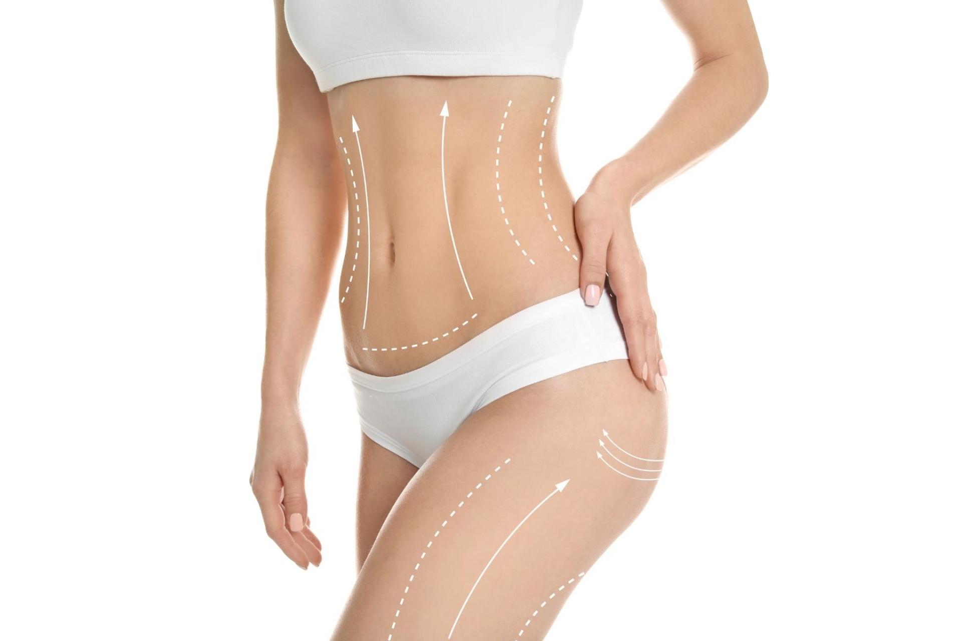 Clínica Fercasy: tratamiento corporal TightSculpting