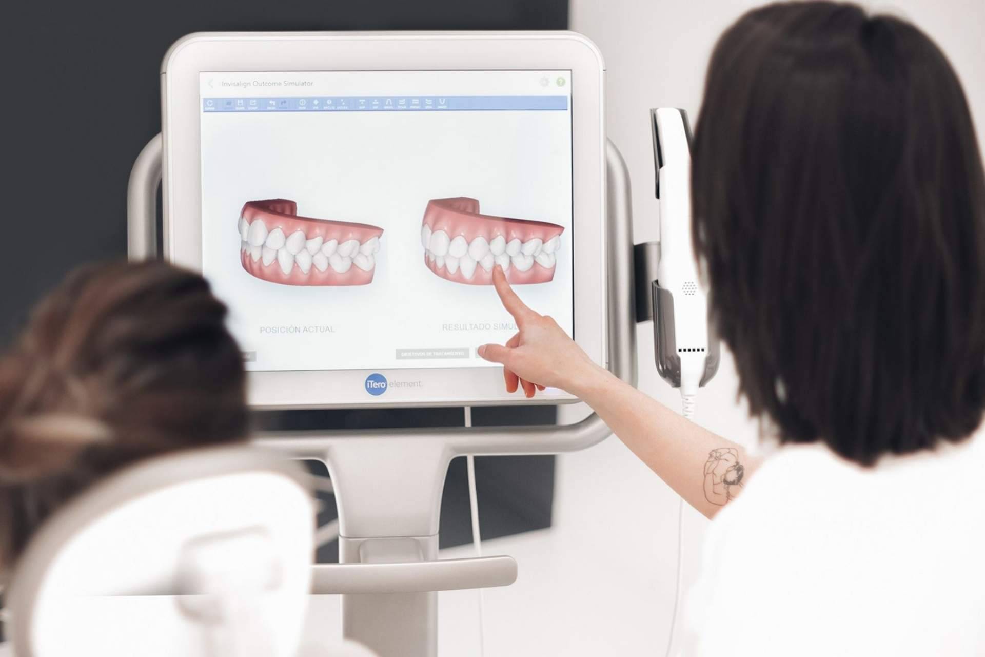 El tratamiento de ortodoncia invisible de la clínica dental Centros en Línea en Cartagena permite conseguir una sonrisa perfecta