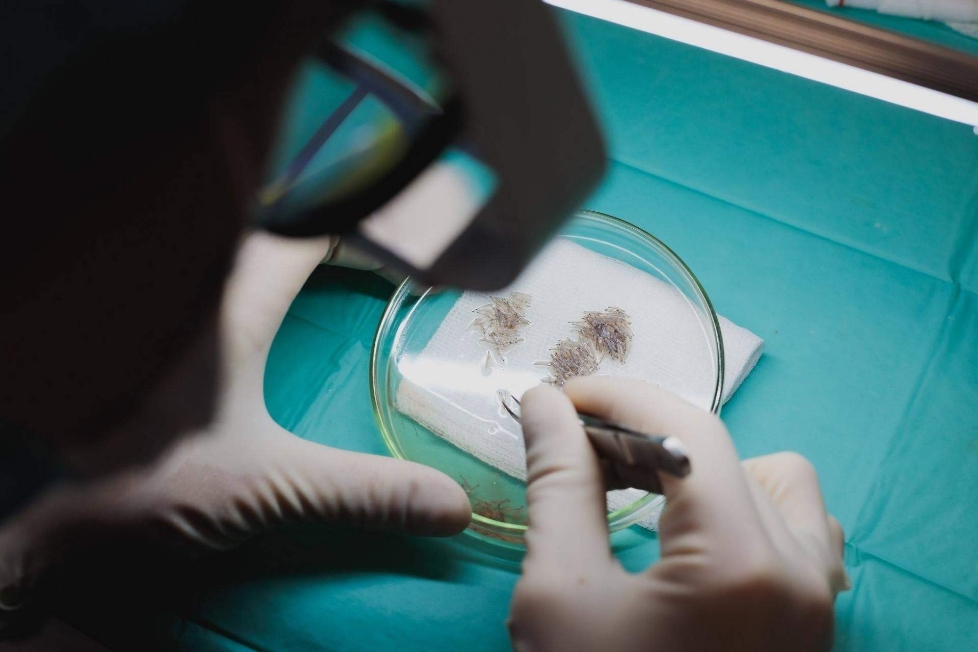El Dr. Alejandro Henao Giraldo realiza microinjertos de barba y cejas en la Clínica Adcure