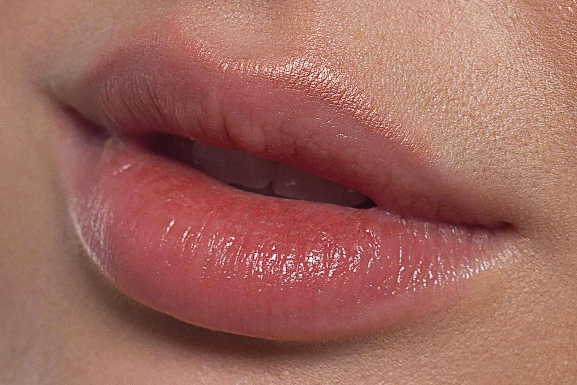 El tratamiento de aumento de labios de ABB Medicina Estética