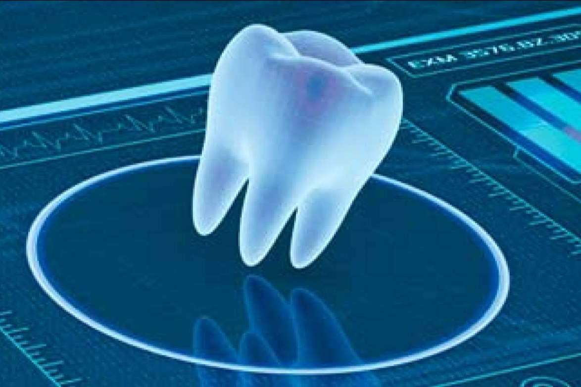 Las técnicas avanzadas en implantología de Clínica Blay Monzó: expertos en odontología digital