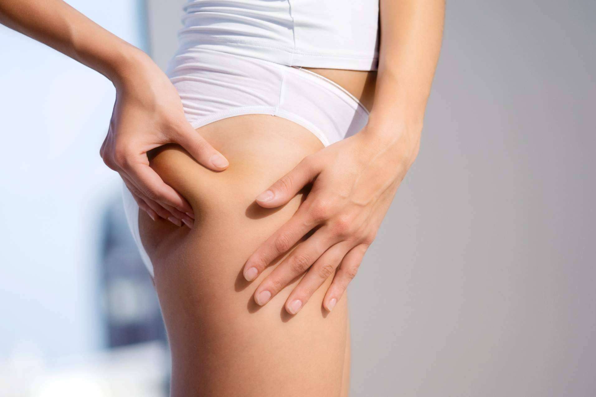 Combatir la celulitis de una forma natural con Sincelut Forte