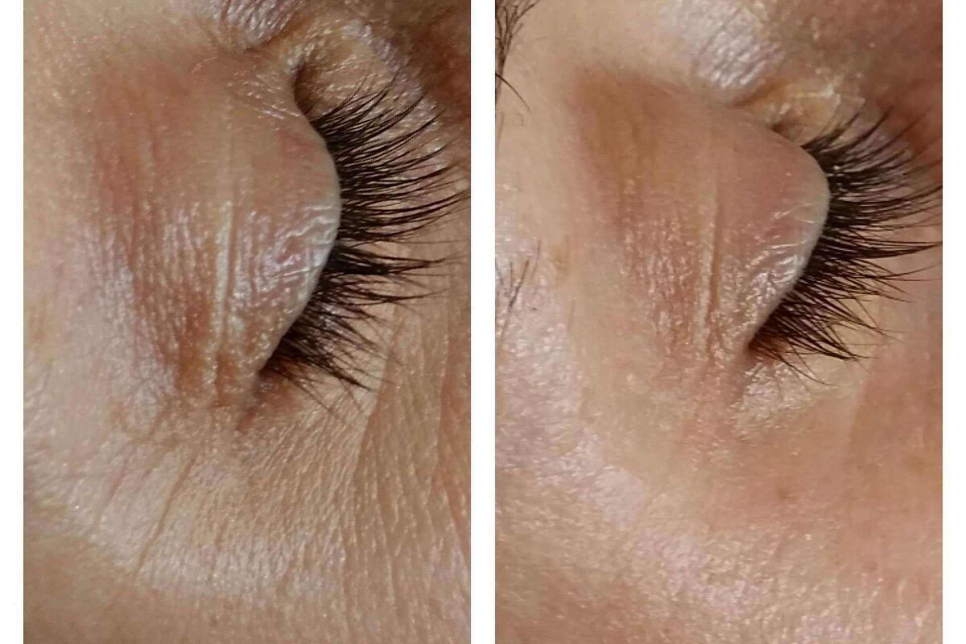 Conseguir una piel de porcelana con tratamiento facial antimanchas y otros tratamientos faciales icónicos de MiCleo&Co