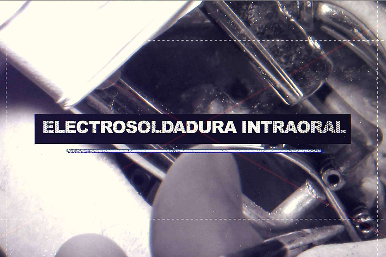 El Dr. Ismael Soriano realiza una técnica de implantes con dientes inmediatos que brinda múltiples beneficios a los pacientes