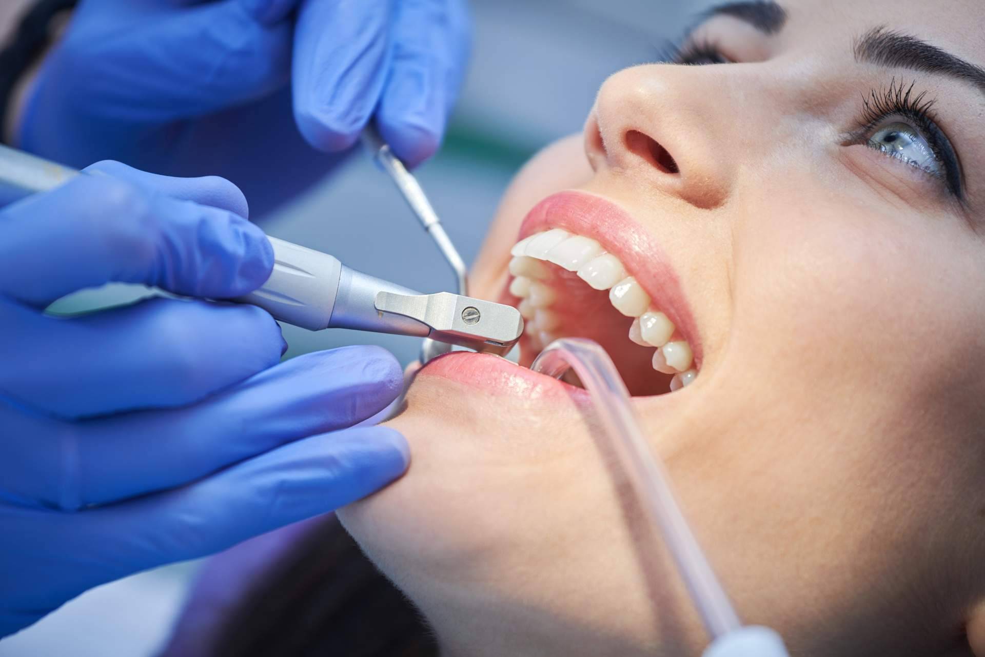 Helident Clínica Dental realiza limpiezas dentales profesionales