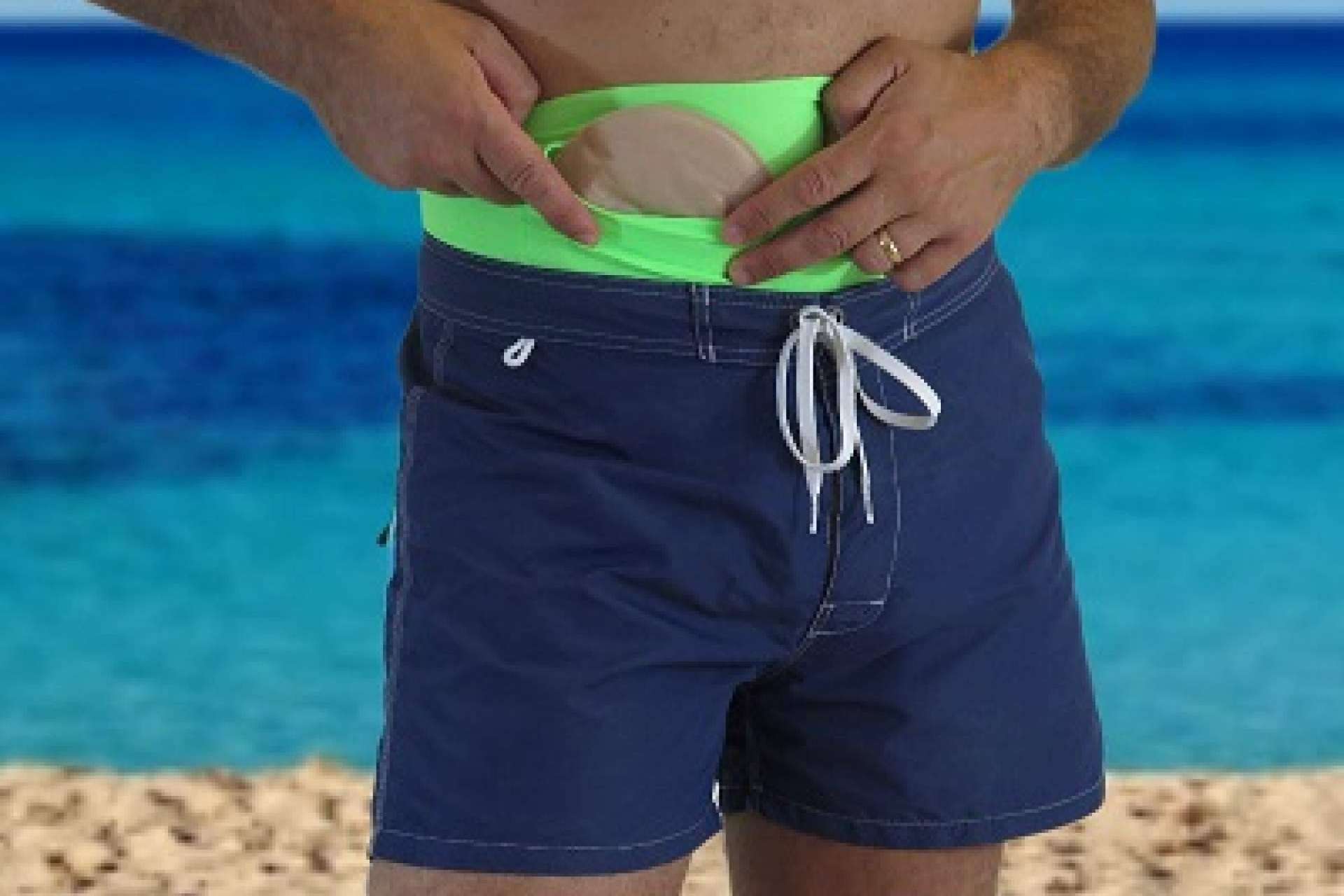 Las fajas para bañarse en la piscina con una ostomía, por Maldita Hernia
