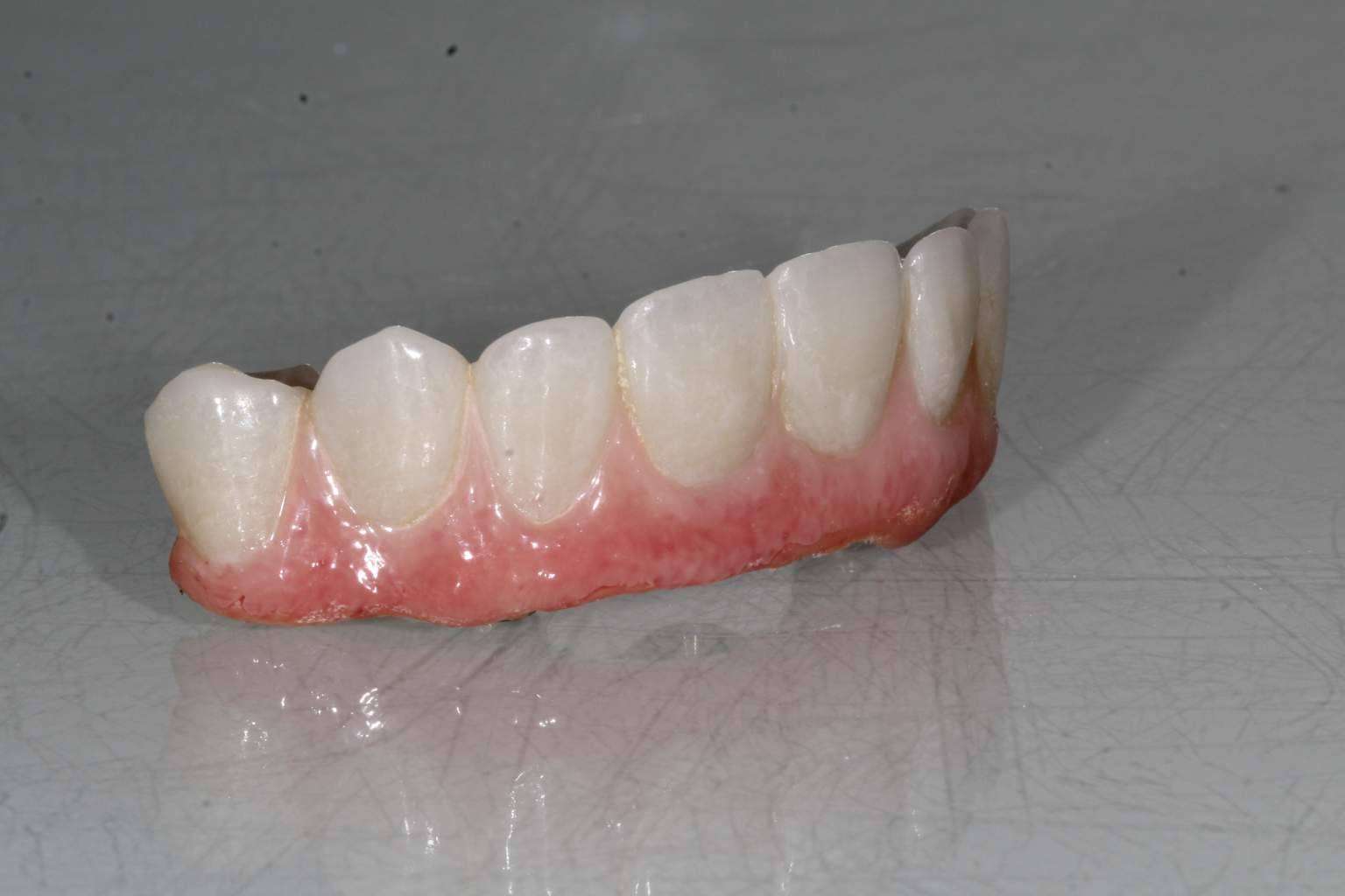 Implant Clinics destaca los beneficios de su tratamiento ALL ON 4