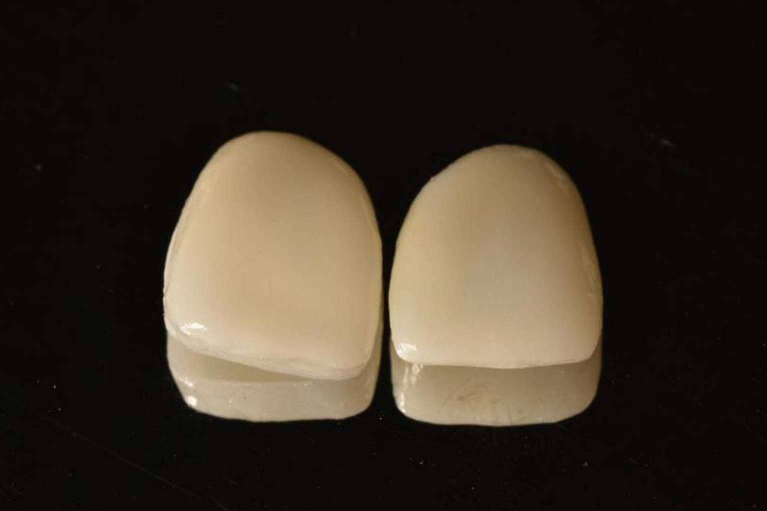 ¿Cuáles son las ventajas de los tratamientos de estética dental? Implant Clinics