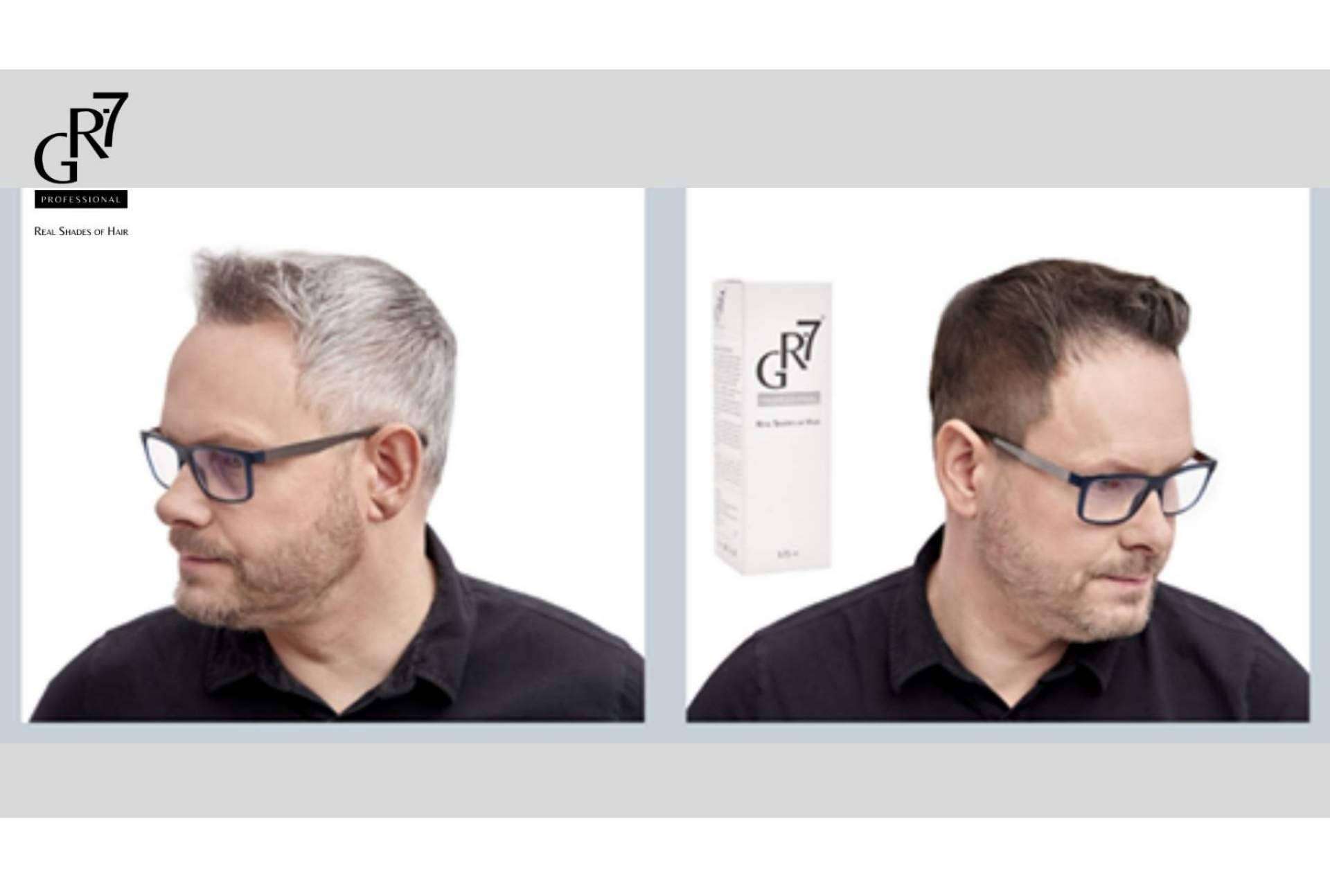 Estimular la producción de melanina para que desaparezcan las canas con GR-7 Professional