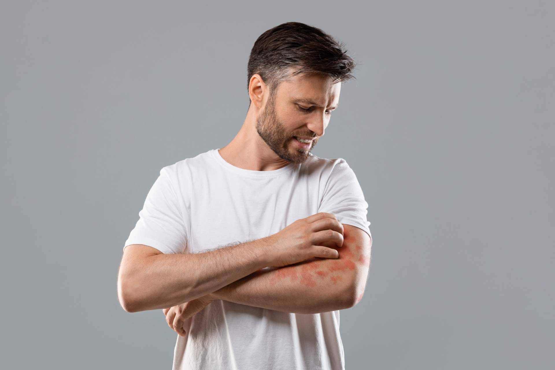 El tratamiento efectivo para la psoriasis de Soriasel