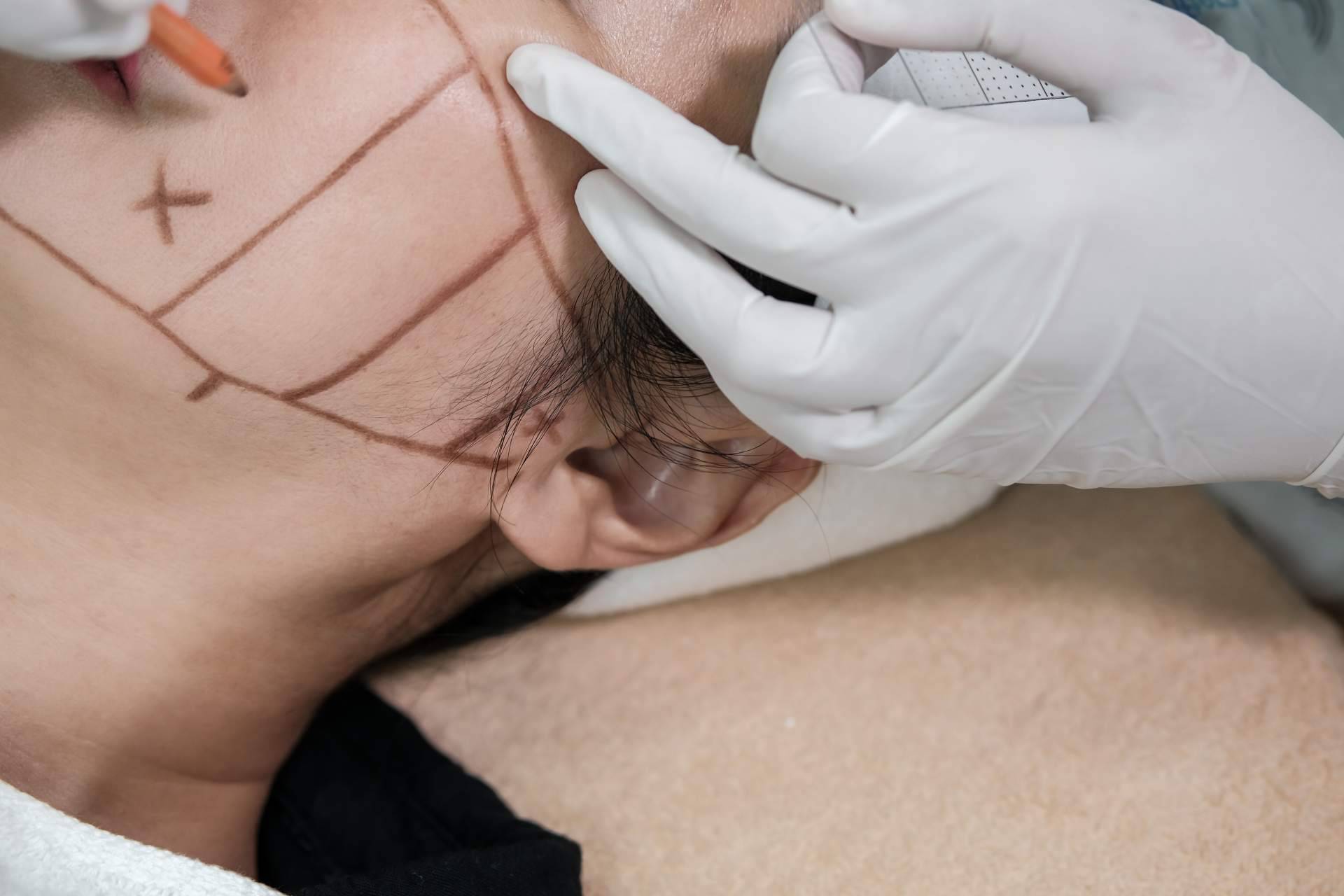 HIFU Facial con Ultrasonidos, la apuesta de CB Clinic