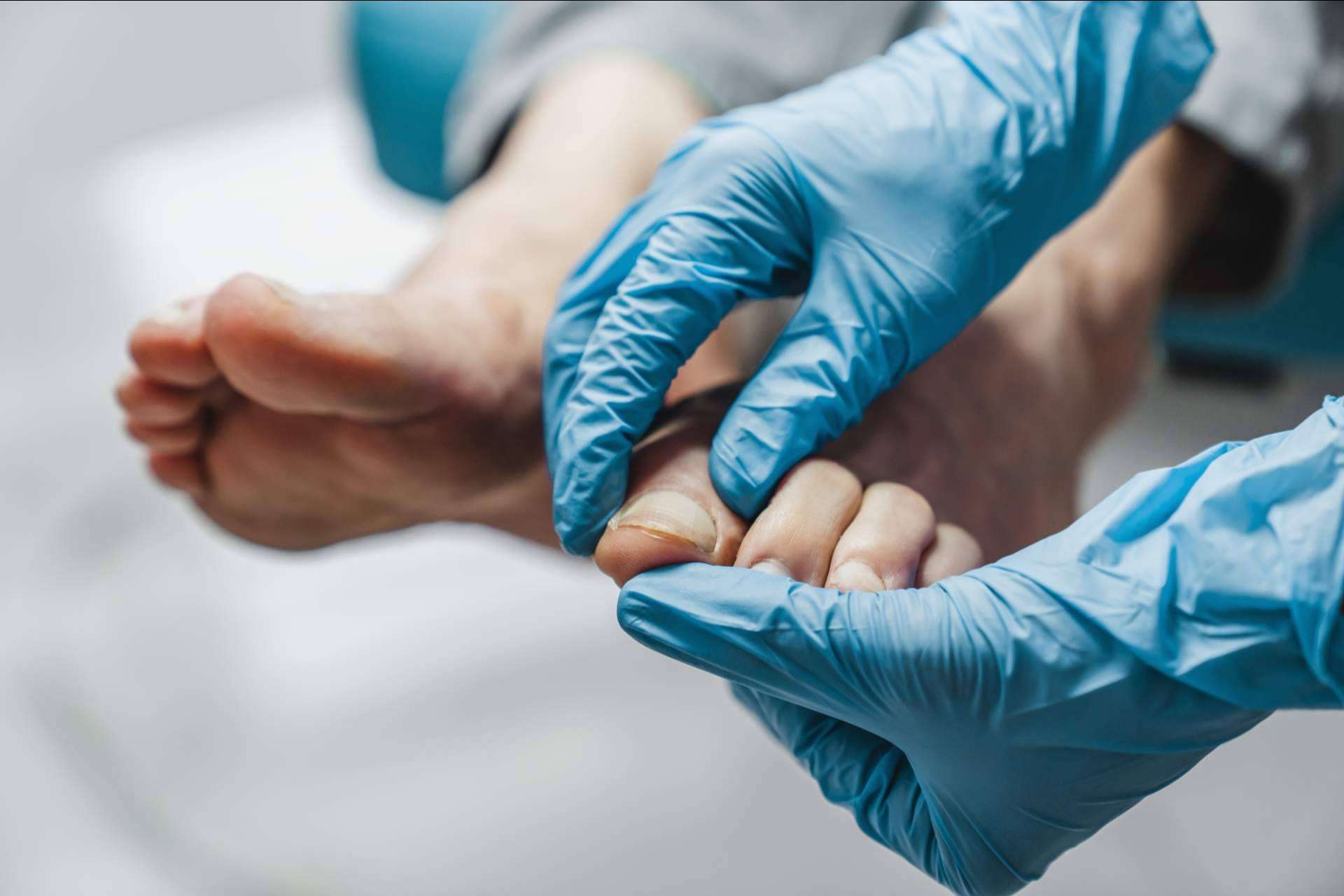 Tratar las afecciones de los pies a tiempo a través de la quiropodia con los expertos de podología de Clínica Viasalud
