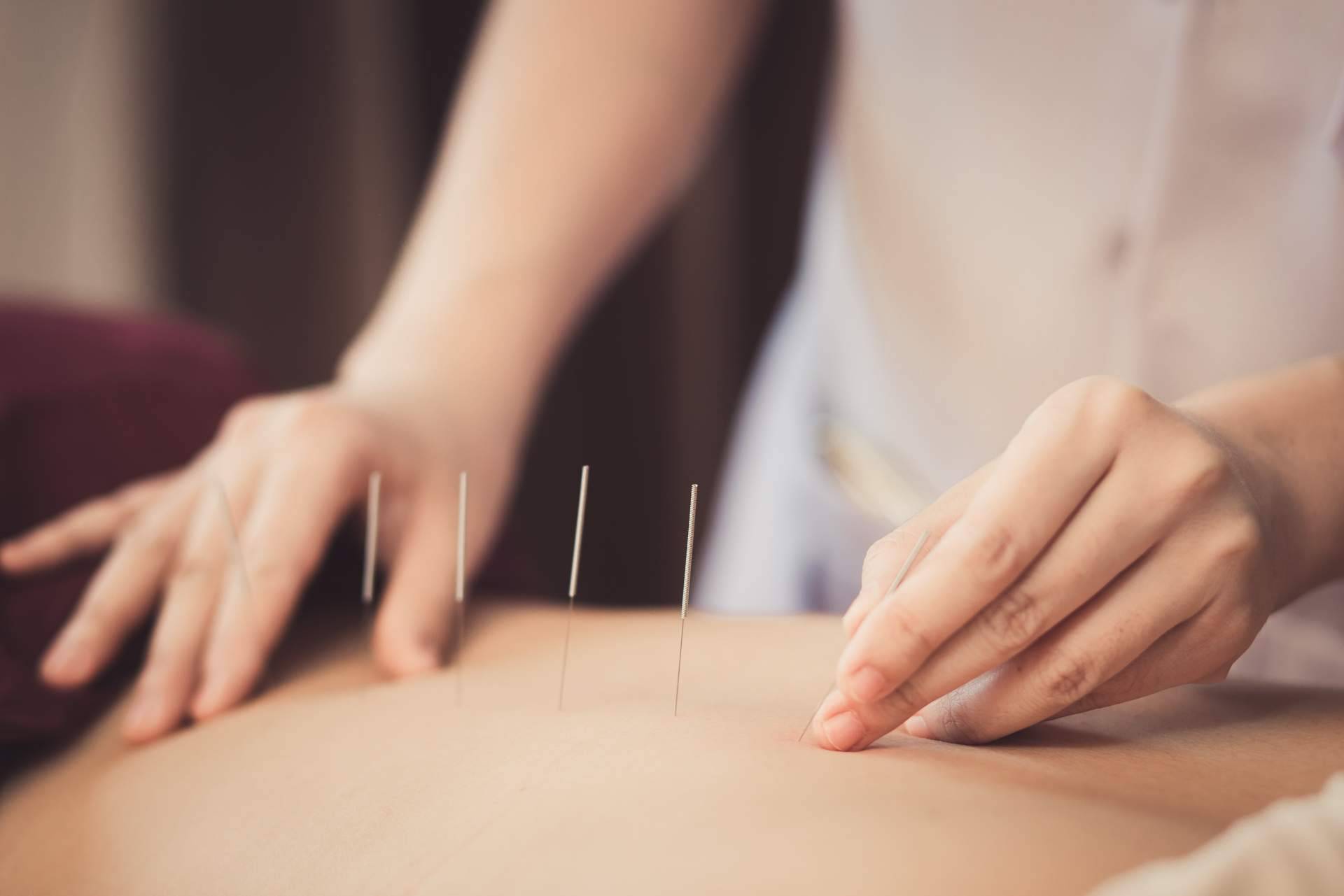 Los beneficios de la terapéutica natural, potencia y equilibra la salud
