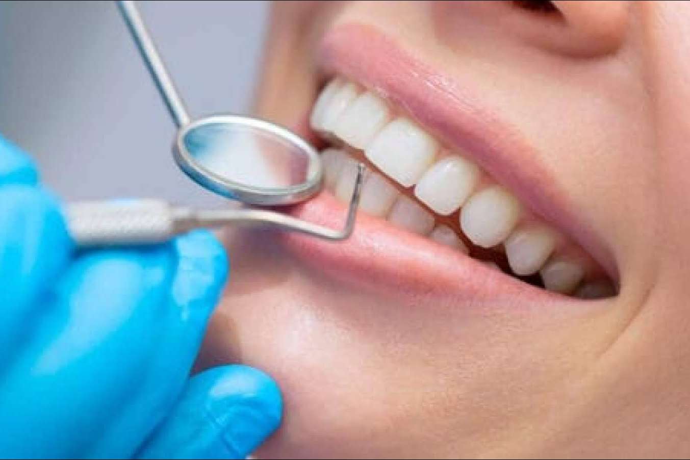 El seguro Adeslas Dental ofrece una buena salud bucal a un precio asequible