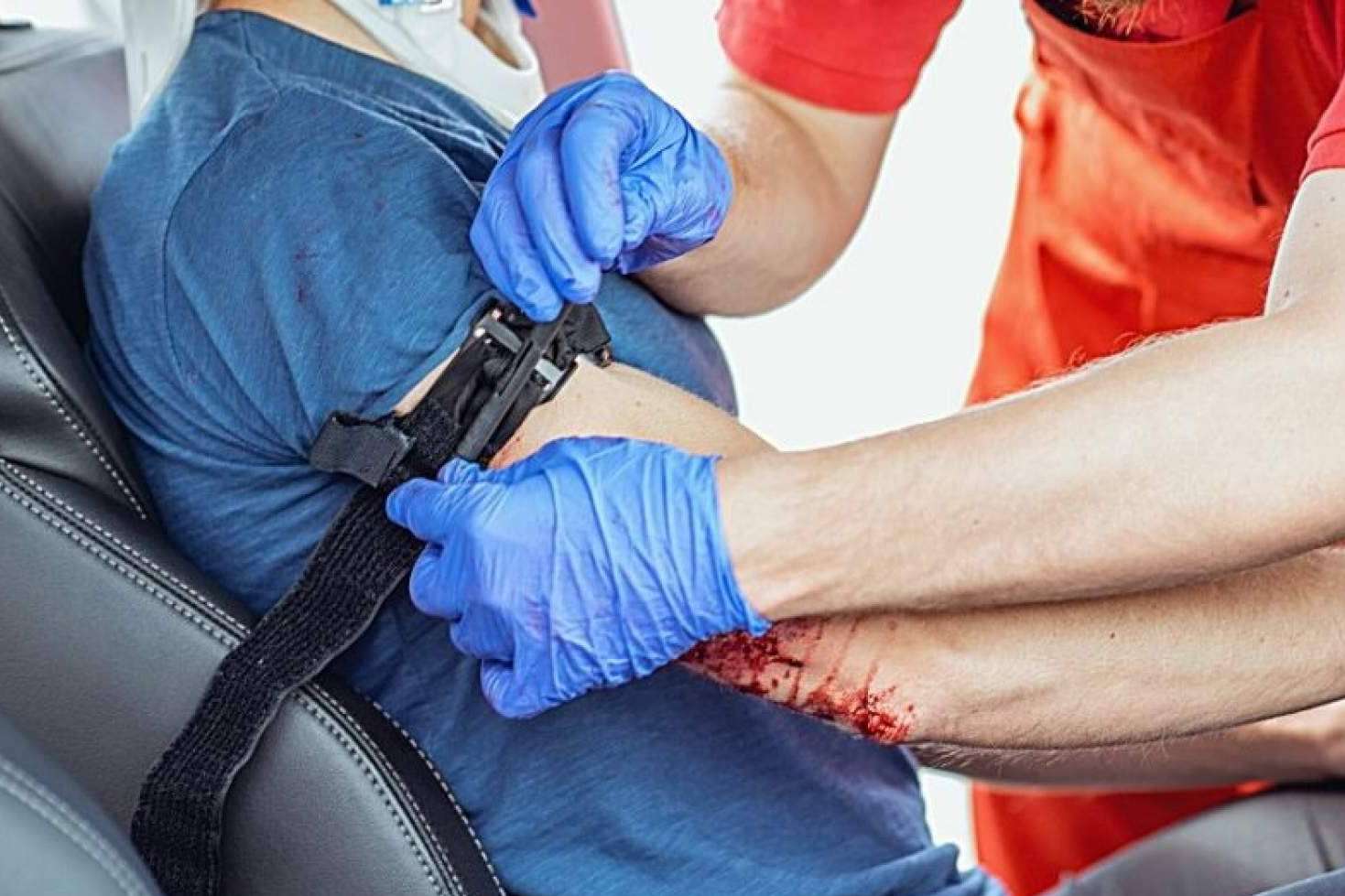 ¿Cuándo y cómo se debe hacer un torniquete?