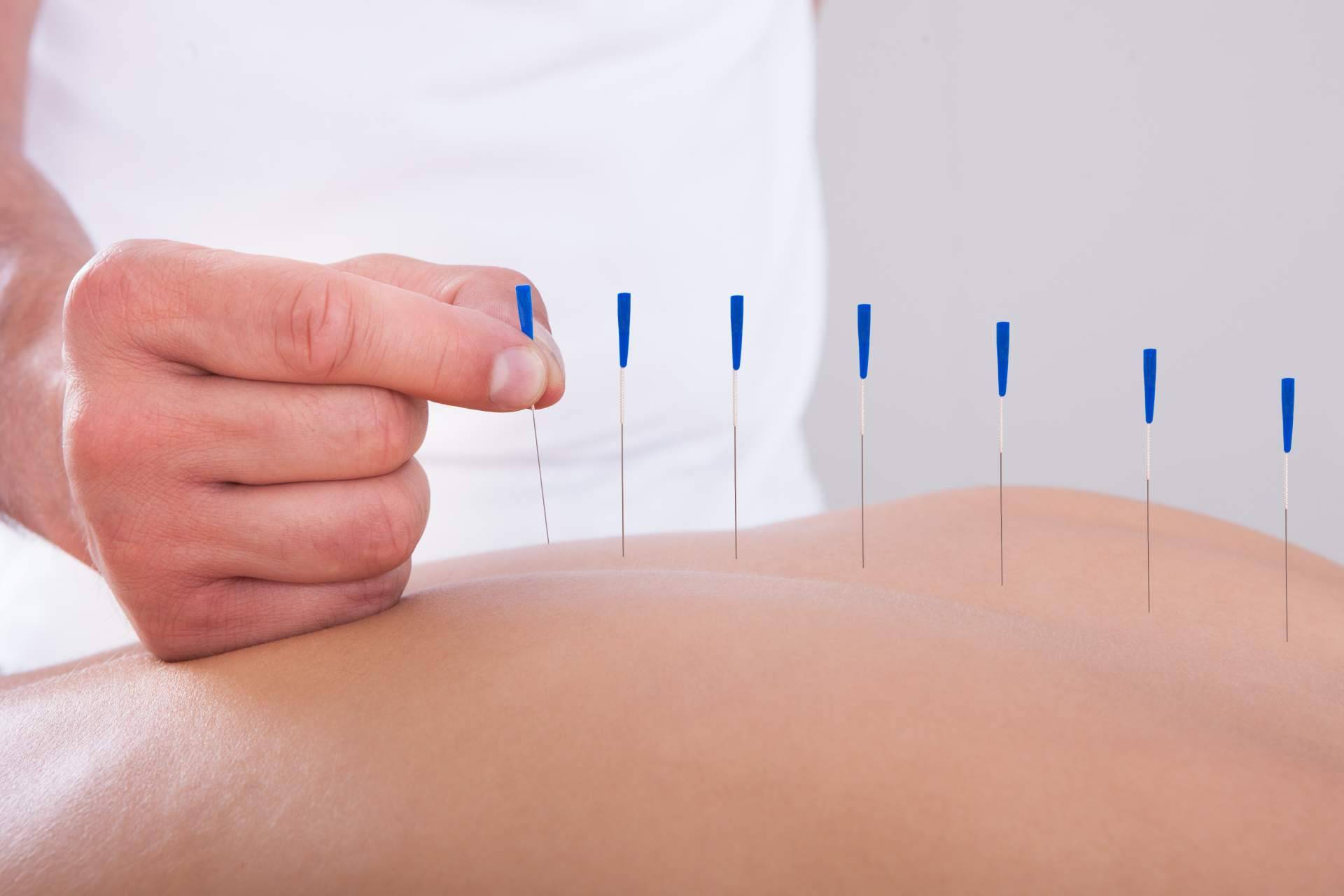Trabajar de acupuntor y osteópata con formación internacional profesional