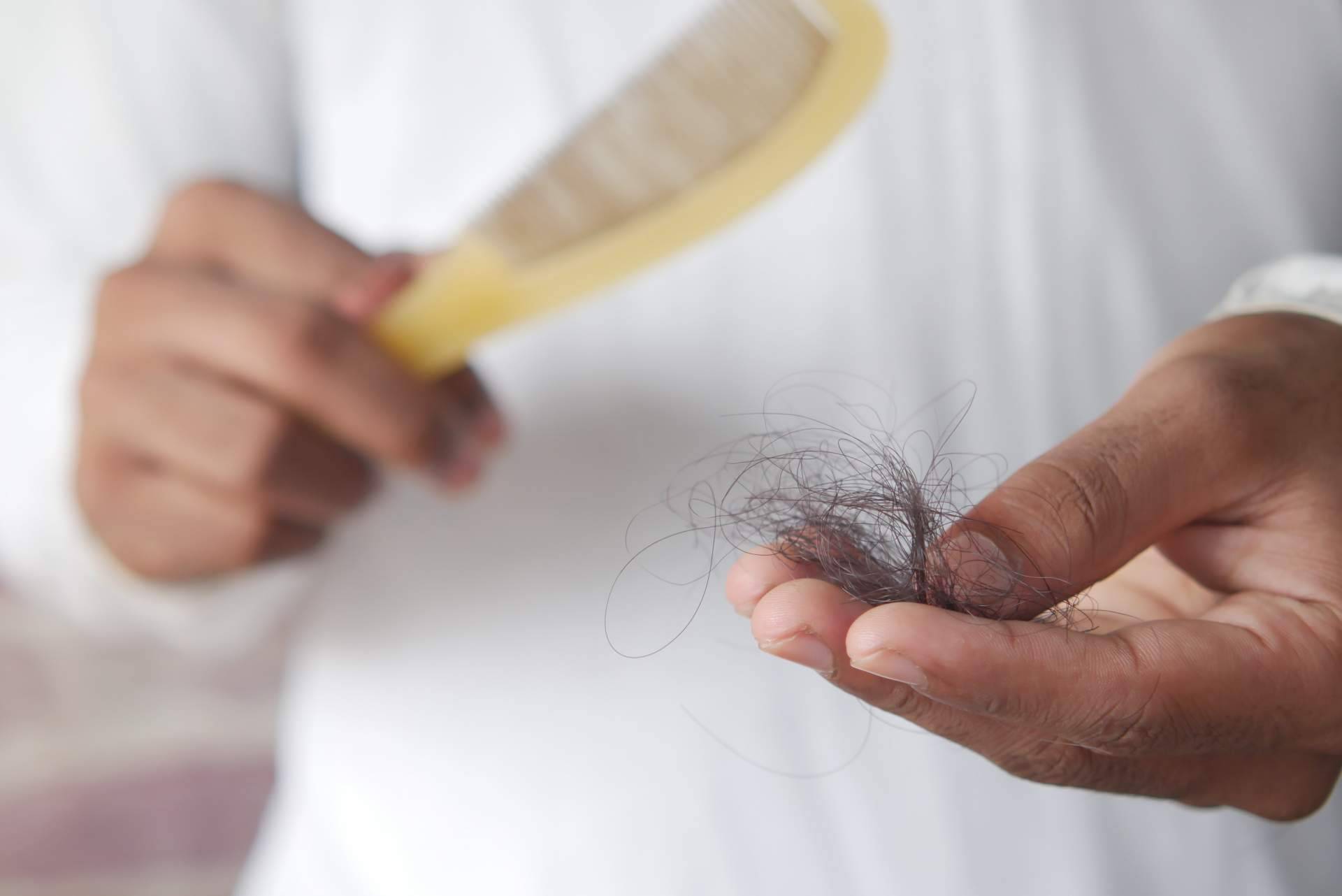 Las enfermedades autoinmunes que provocan la caída del cabello están aumentando, según tricólogos y especialistas capilares