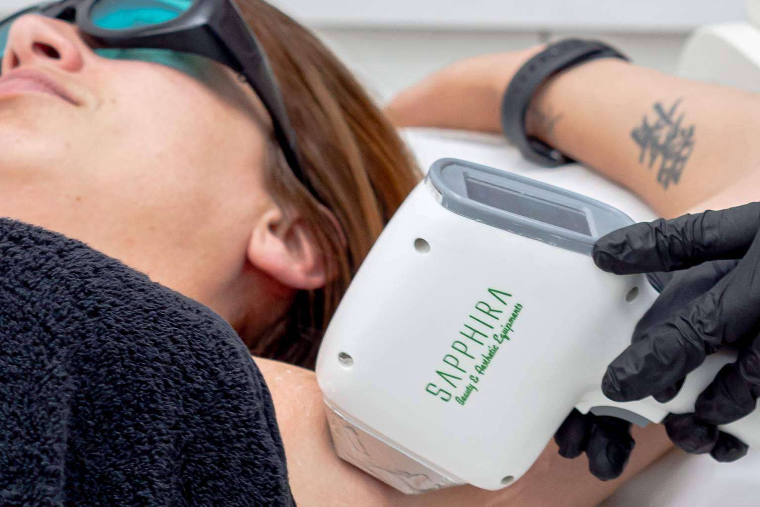 La eficacia en la depilación laser, por Sapphira Privé