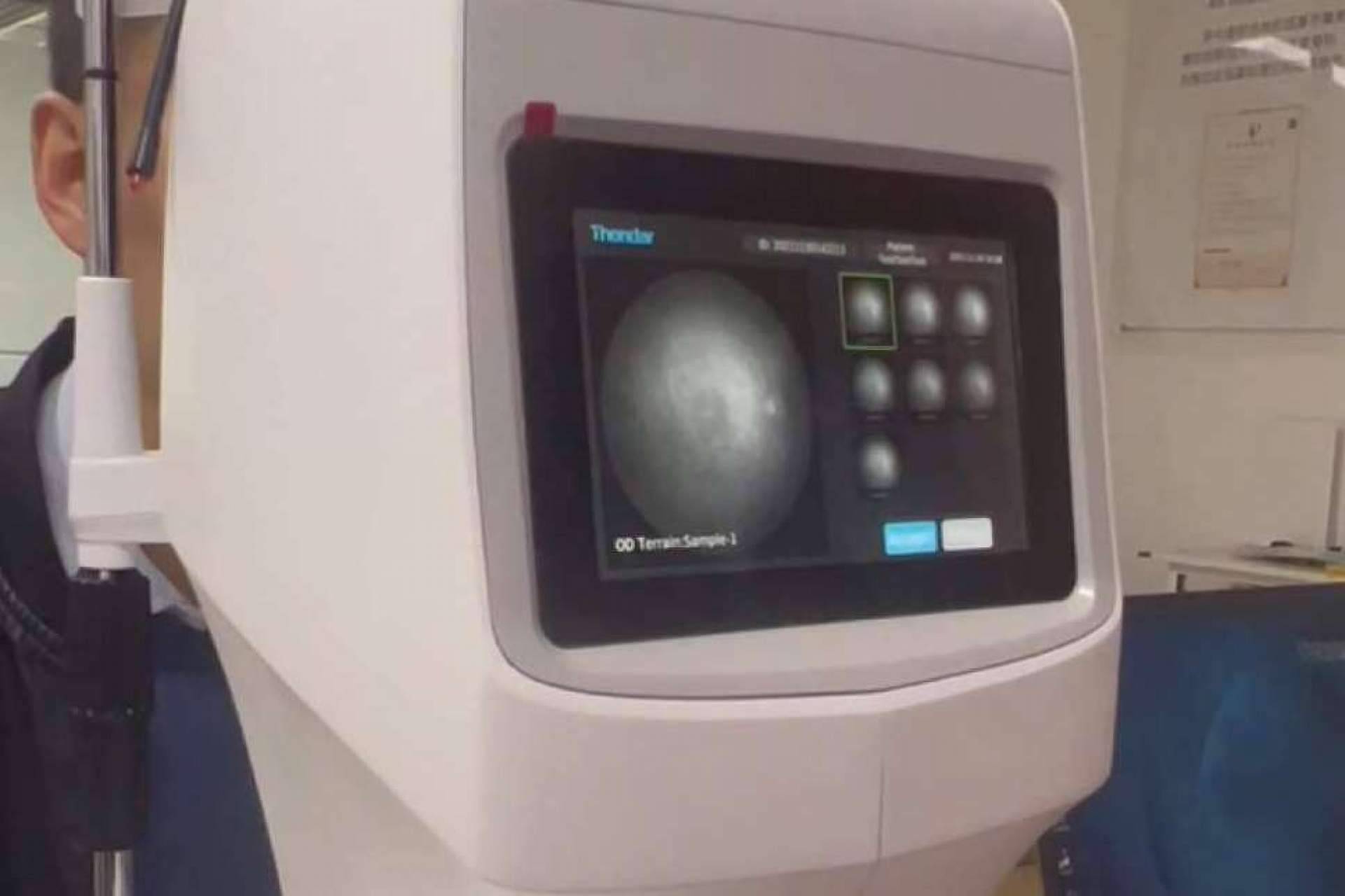 GX2 sobre el control de la miopía con el sistema de diagnóstico multiespectral