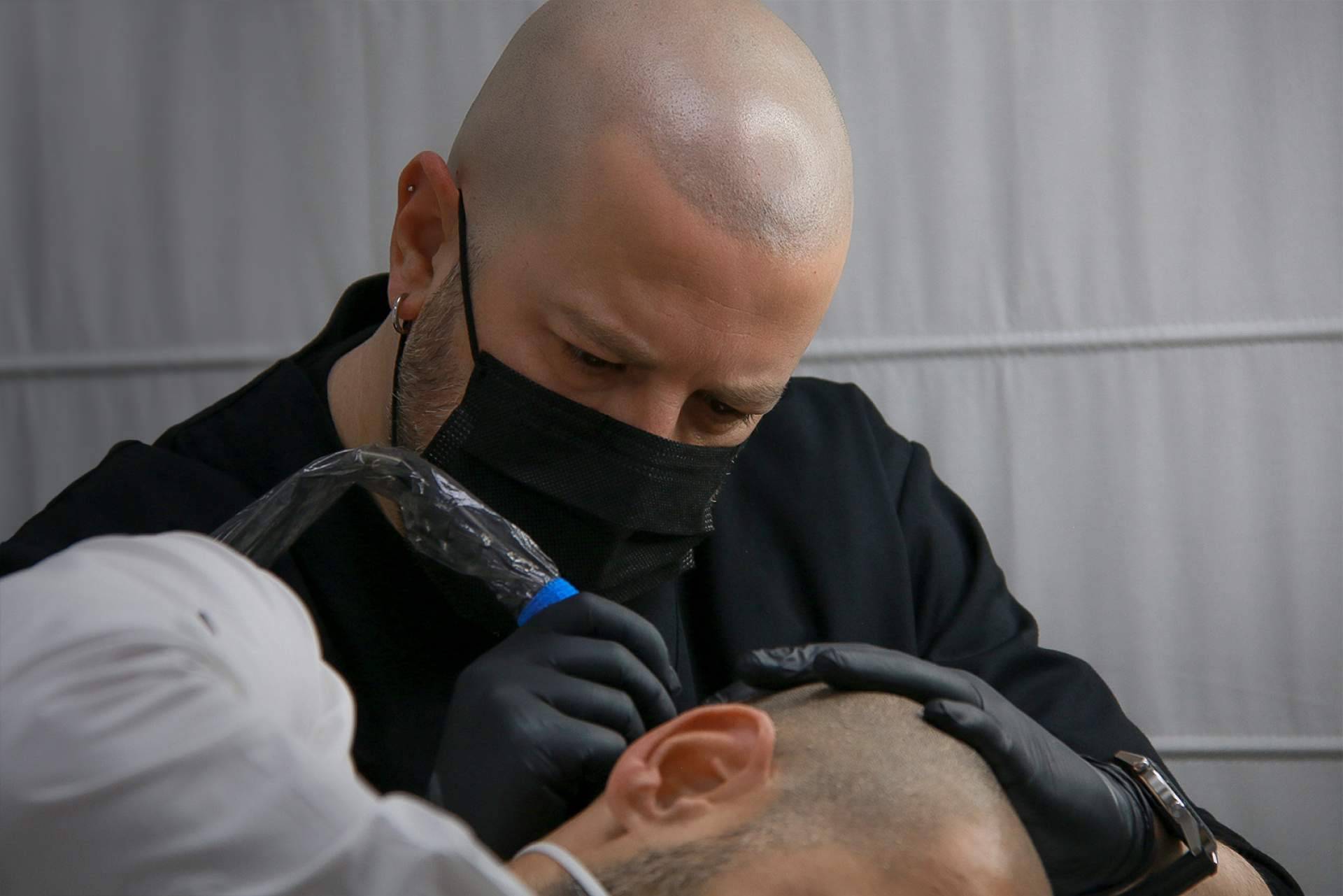 Cuáles son los beneficios de la micropigmentación capilar que realiza INBLAK