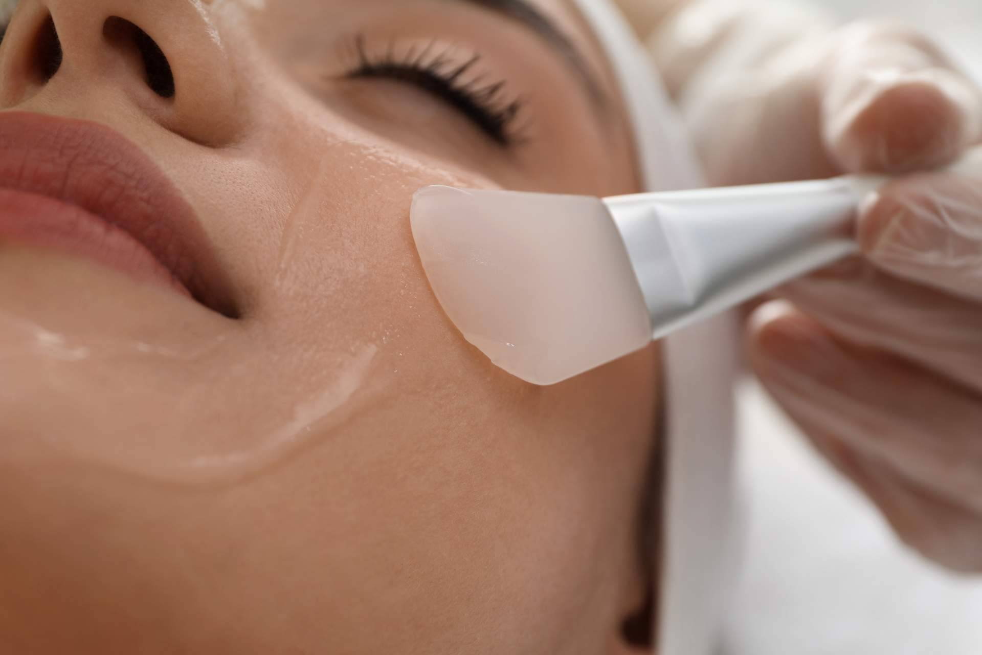 Peeling químico para lograr una piel saludable y luminosa, en Espacio Hebe