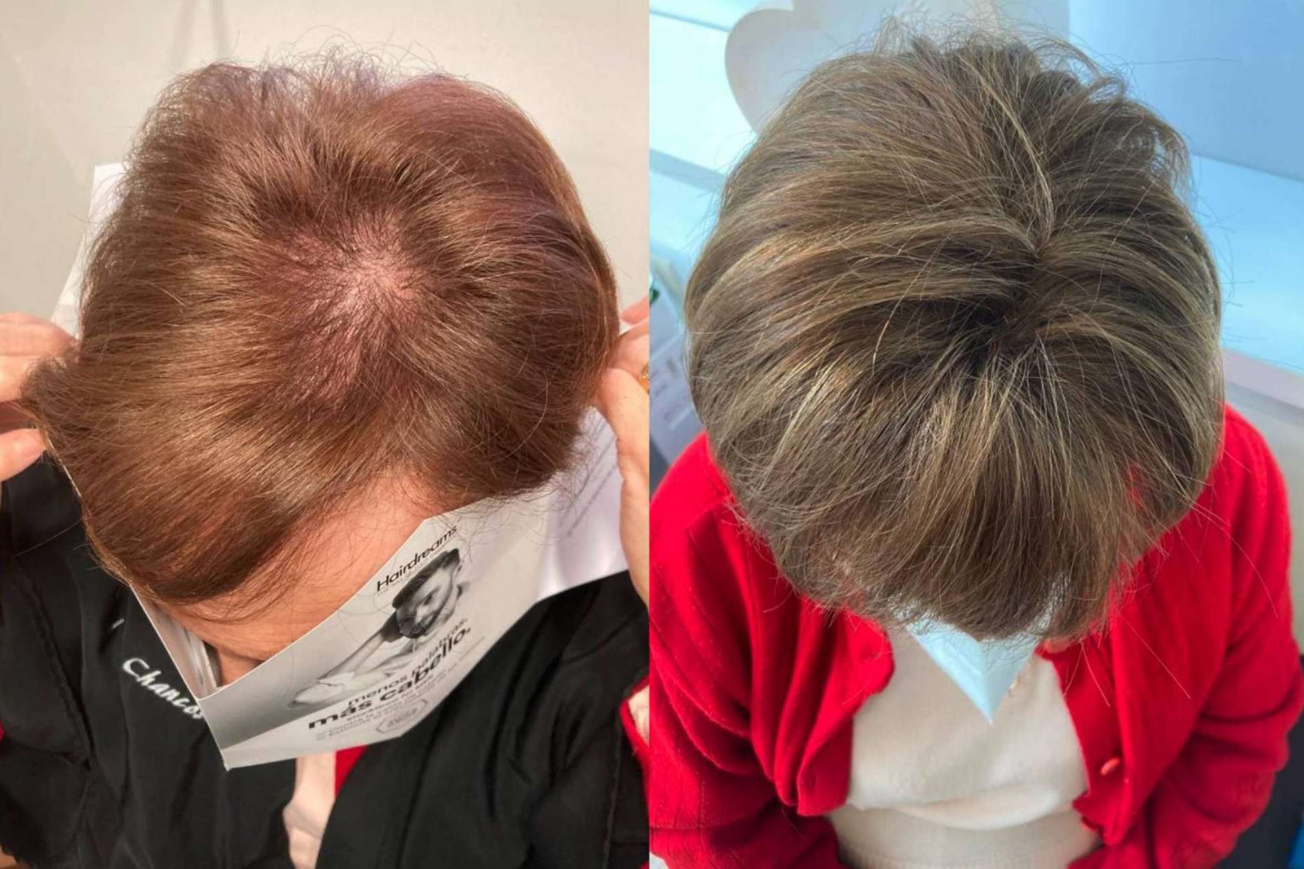 Mar Chancosa y las extensiones de cabello 100% de cabello natural de Hairdreams