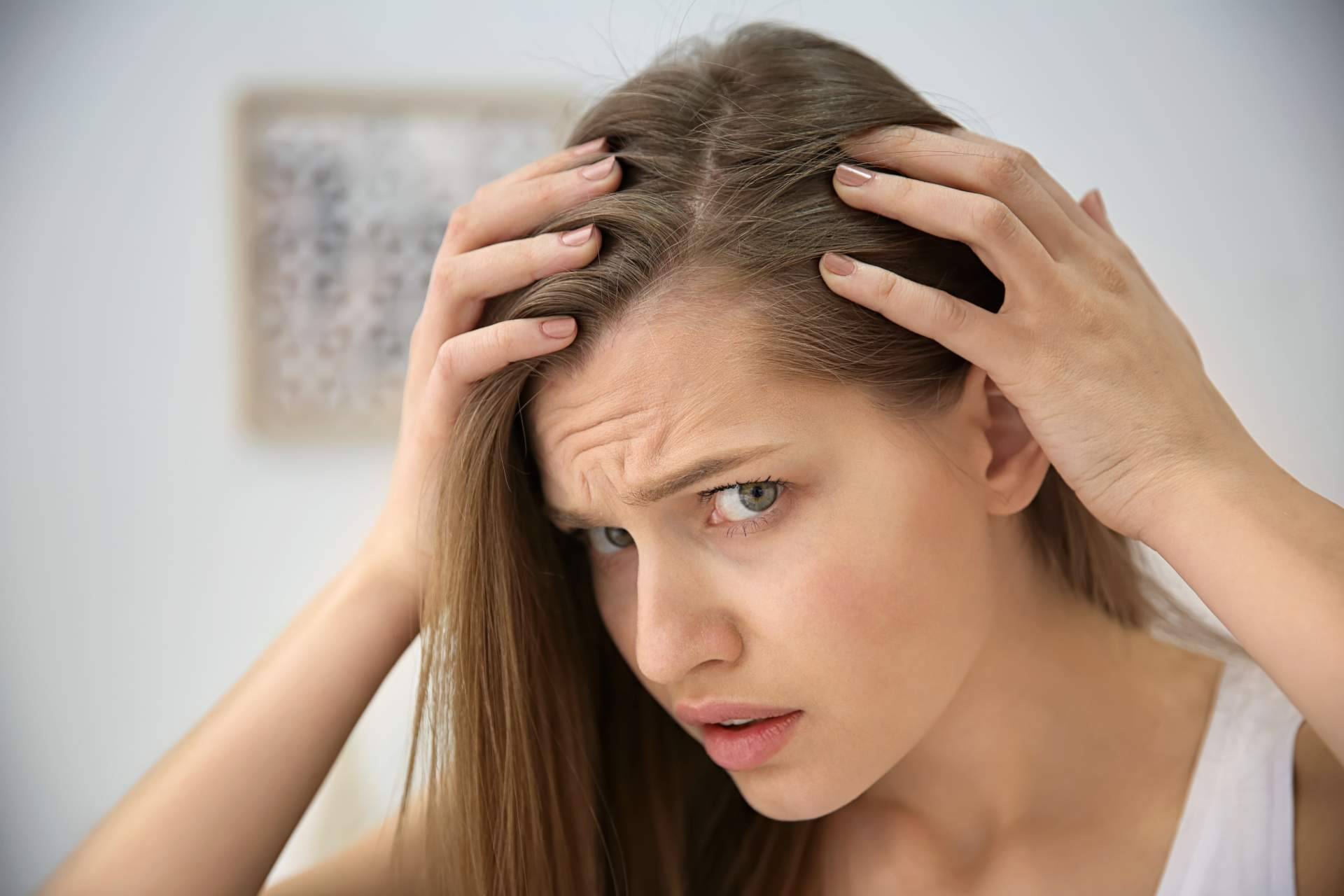 Los tipos más comunes de alopecia femenina y su tratamiento