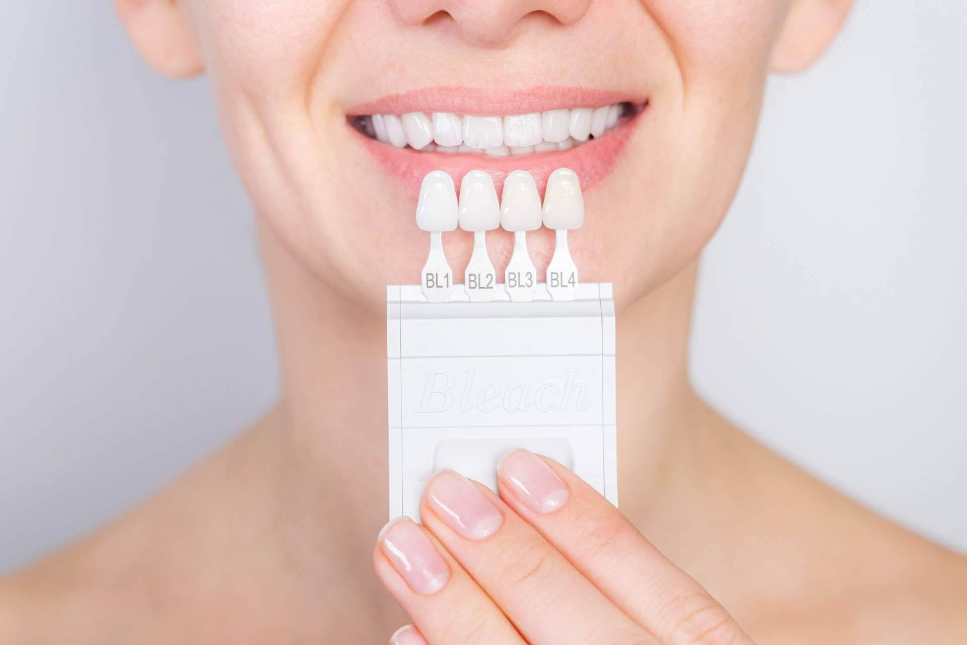 Clínica Dental Delgado mejora la sonrisa de sus pacientes con carillas dentales