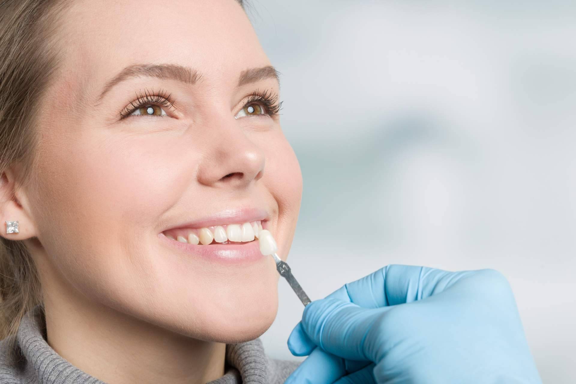 Conseguir una sonrisa perfecta de la mano de los profesionales de la clínica Carlos Saiz Smile