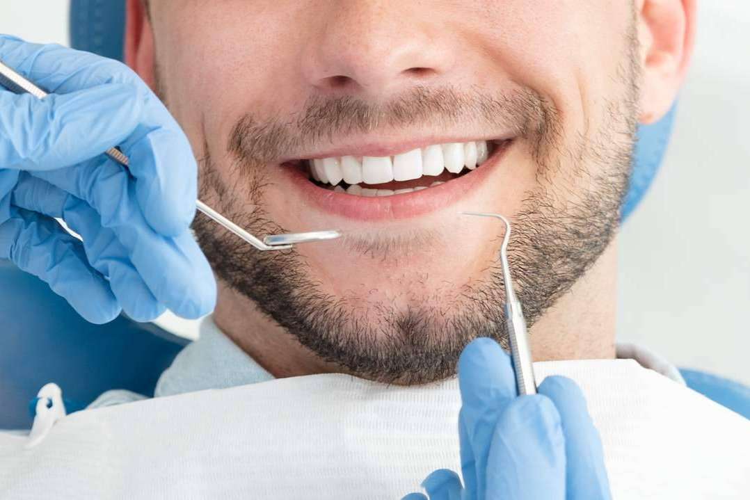 ¿Qué problemas estéticos se pueden solucionar con las carillas dentales?