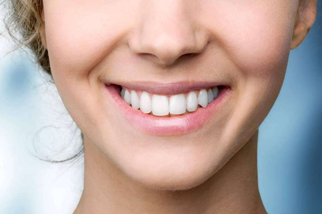 Después de un blanqueamiento dental, ¿cómo hay que cuidar los dientes?