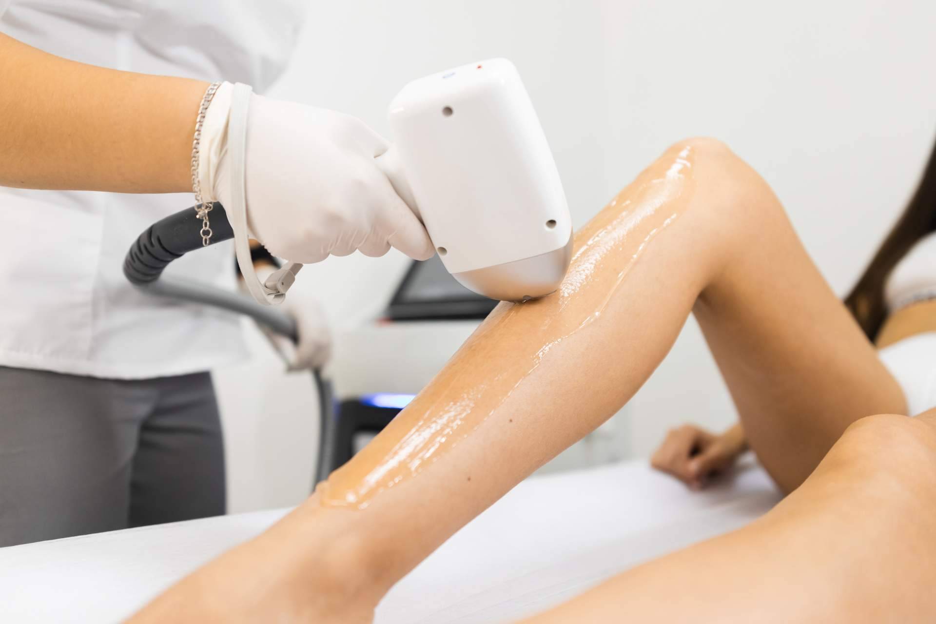 Dermativa, depilación facial definitiva