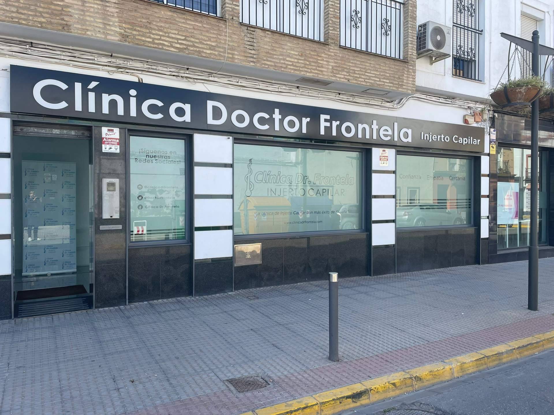 La Clínica Frontela aplica la técnica FUE de injerto capilar