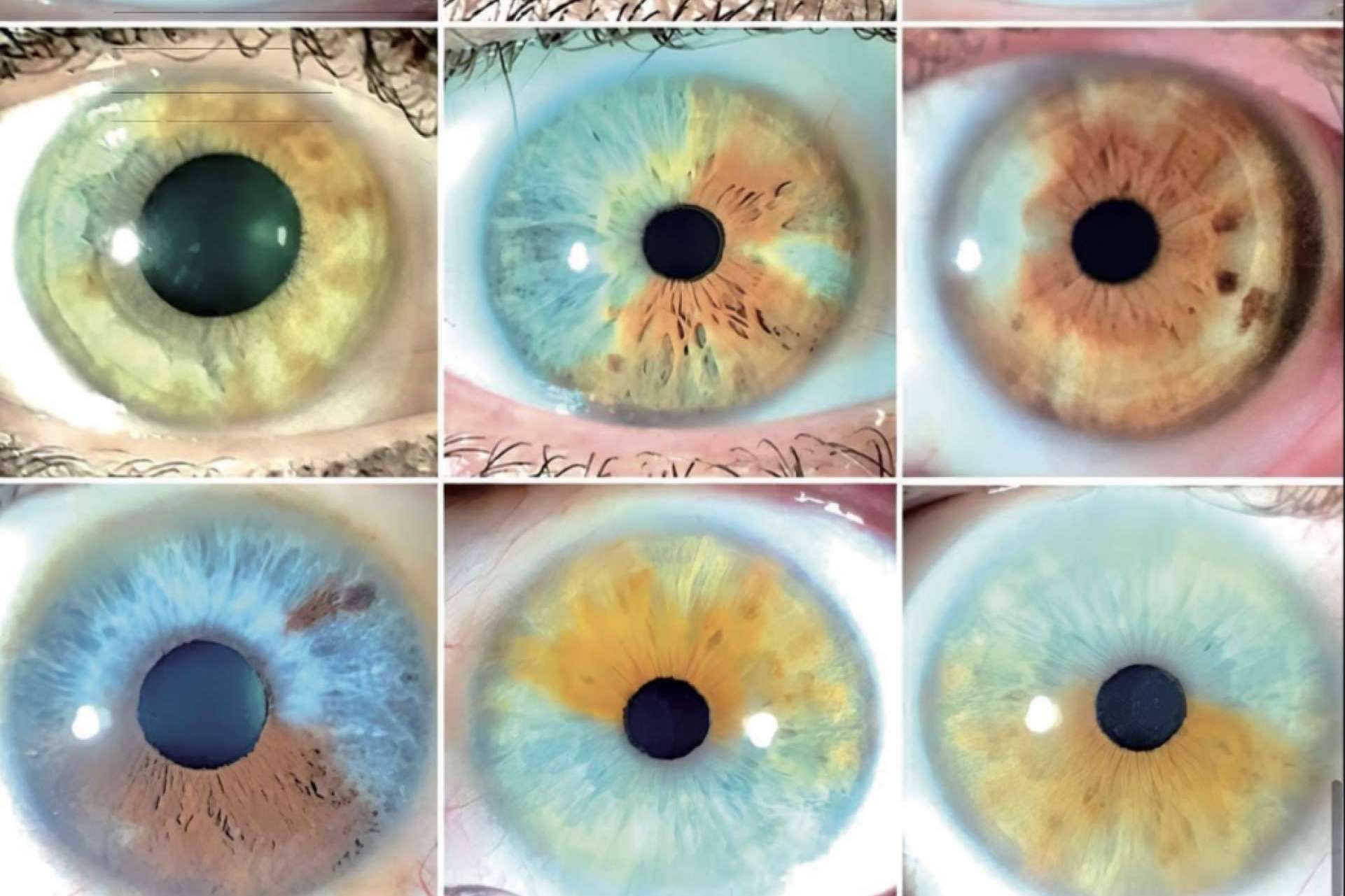 El gran libro Atlas sobre el cambio de color de ojos con láser, con Eyecos