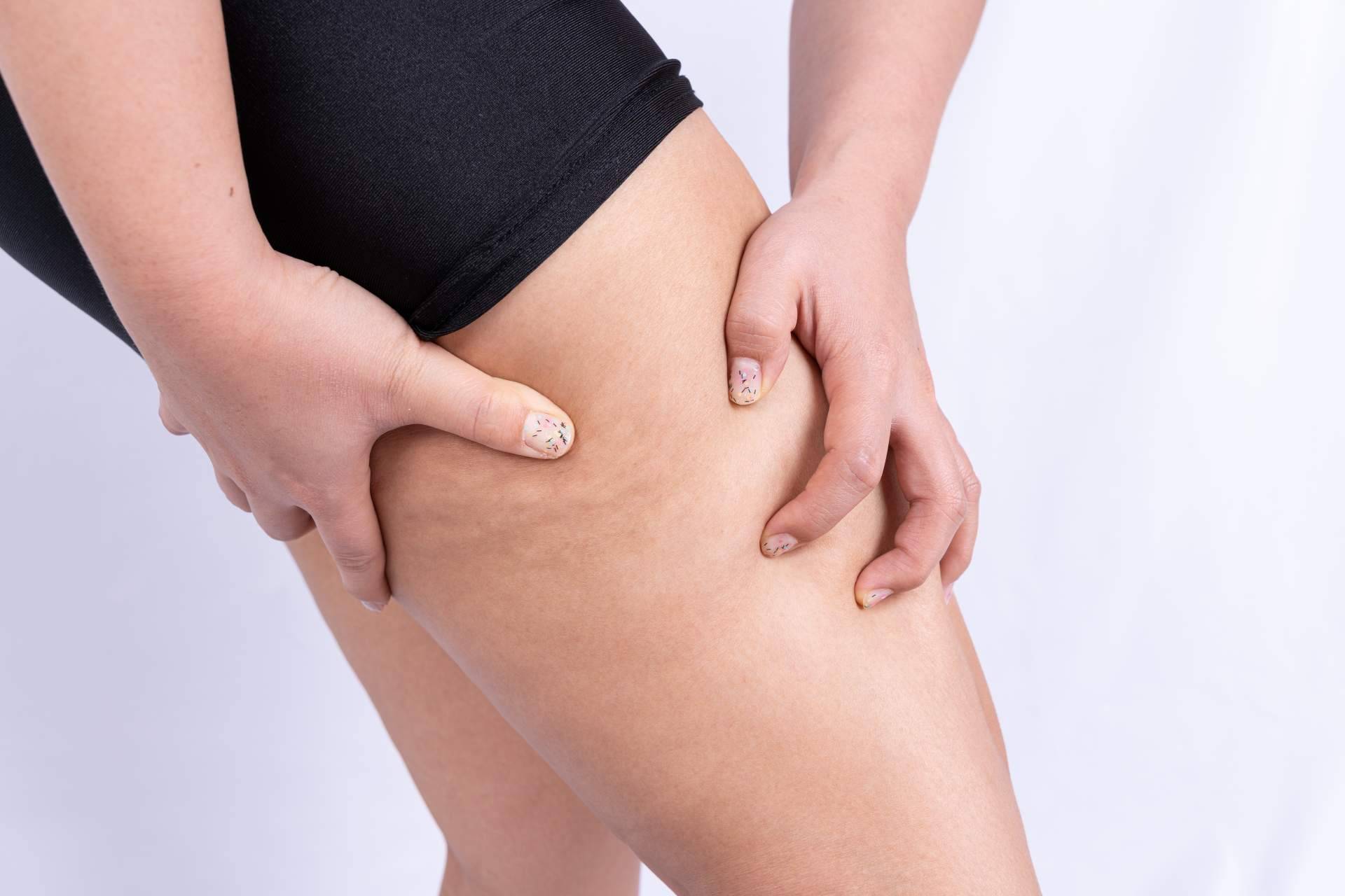 El tratamiento corporal para tratar y reducir la celulitis Vacuslim 48, ¿funciona realmente?