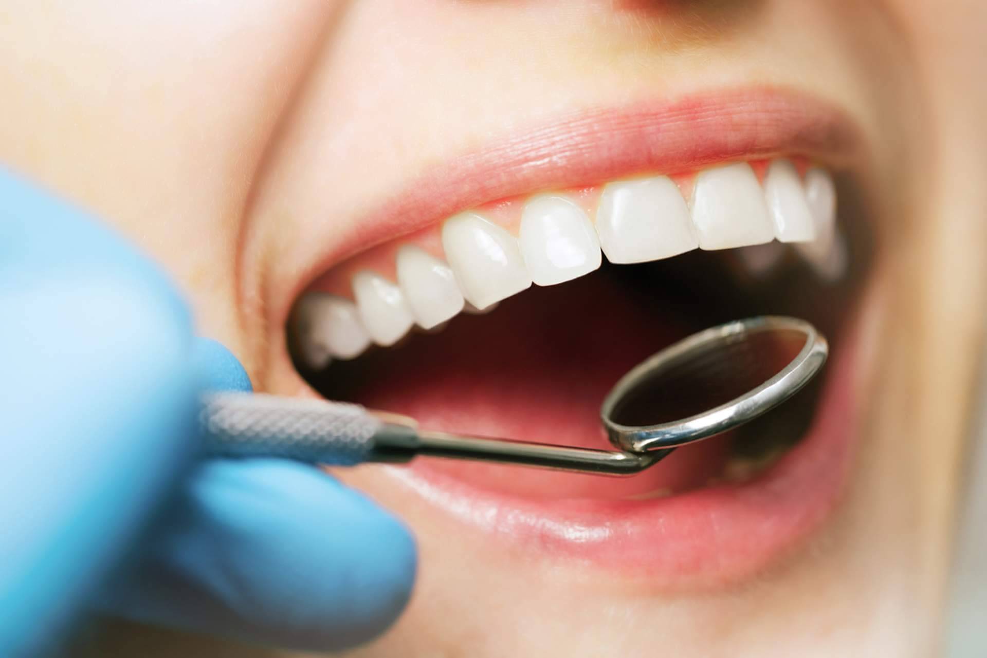 Aspectos a tener en cuenta al elegir una clínica de estética dental