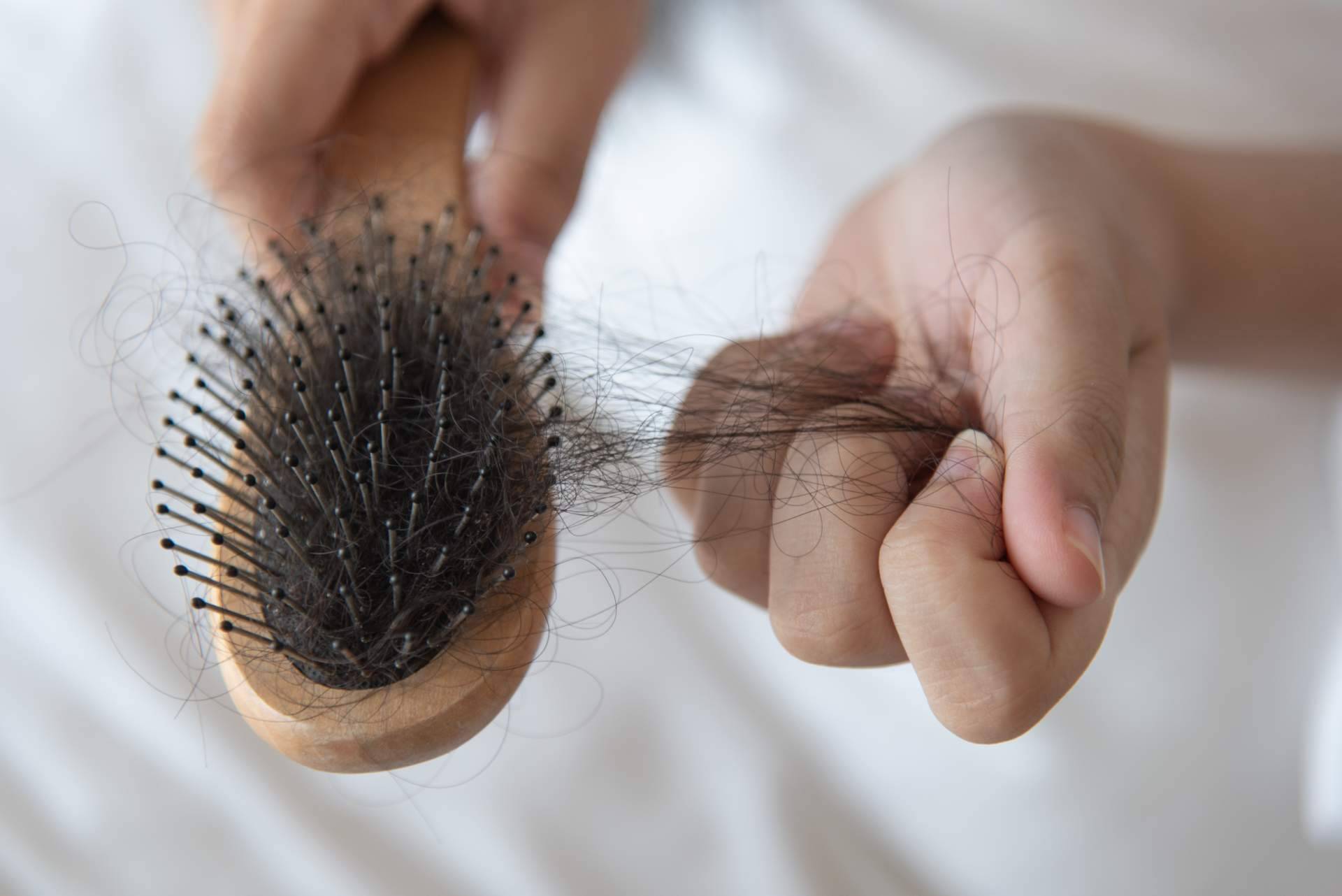 Cómo combatir la alopecia femenina, el método de Capilar Innovation Clinic