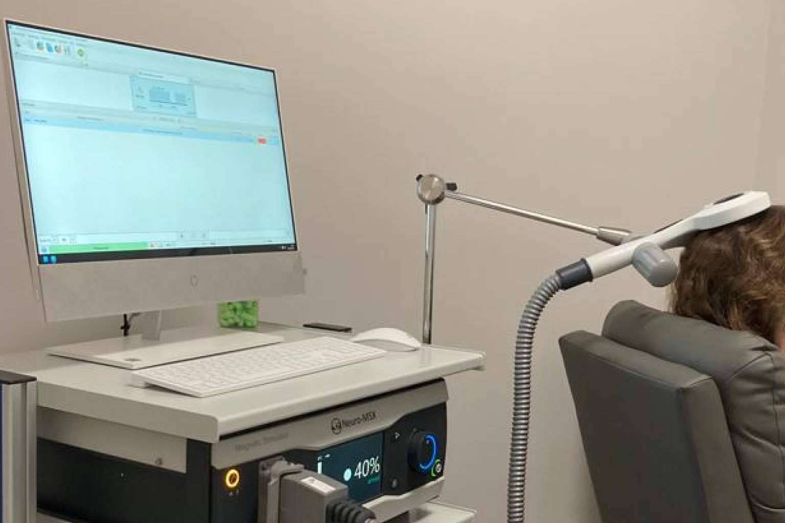 Avances en el tratamiento del dolor crónico, estimulación magnética transcraneal