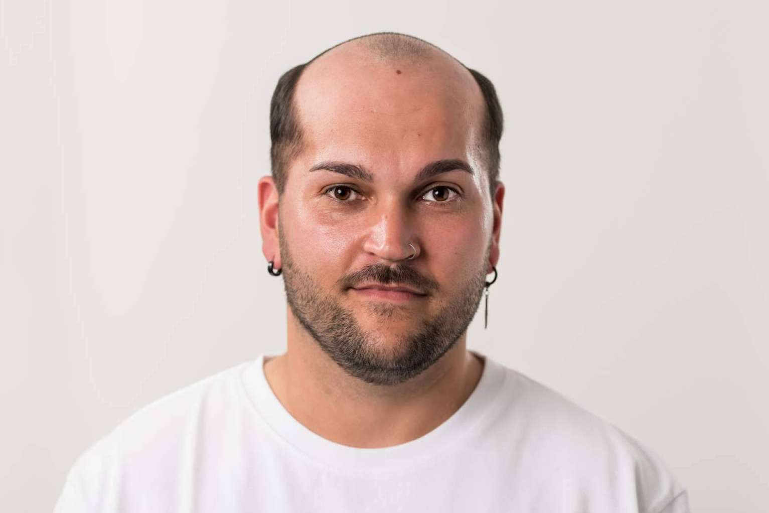 Las prótesis capilares para hombre, un mercado en auge, con Hair Inspira