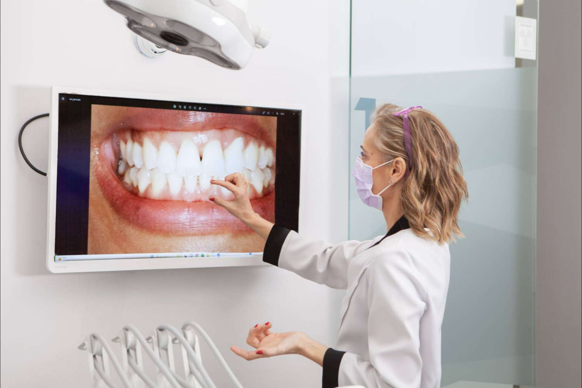 Diseño de sonrisa y estética dental; aspectos clave para lucir una sonrisa perfecta