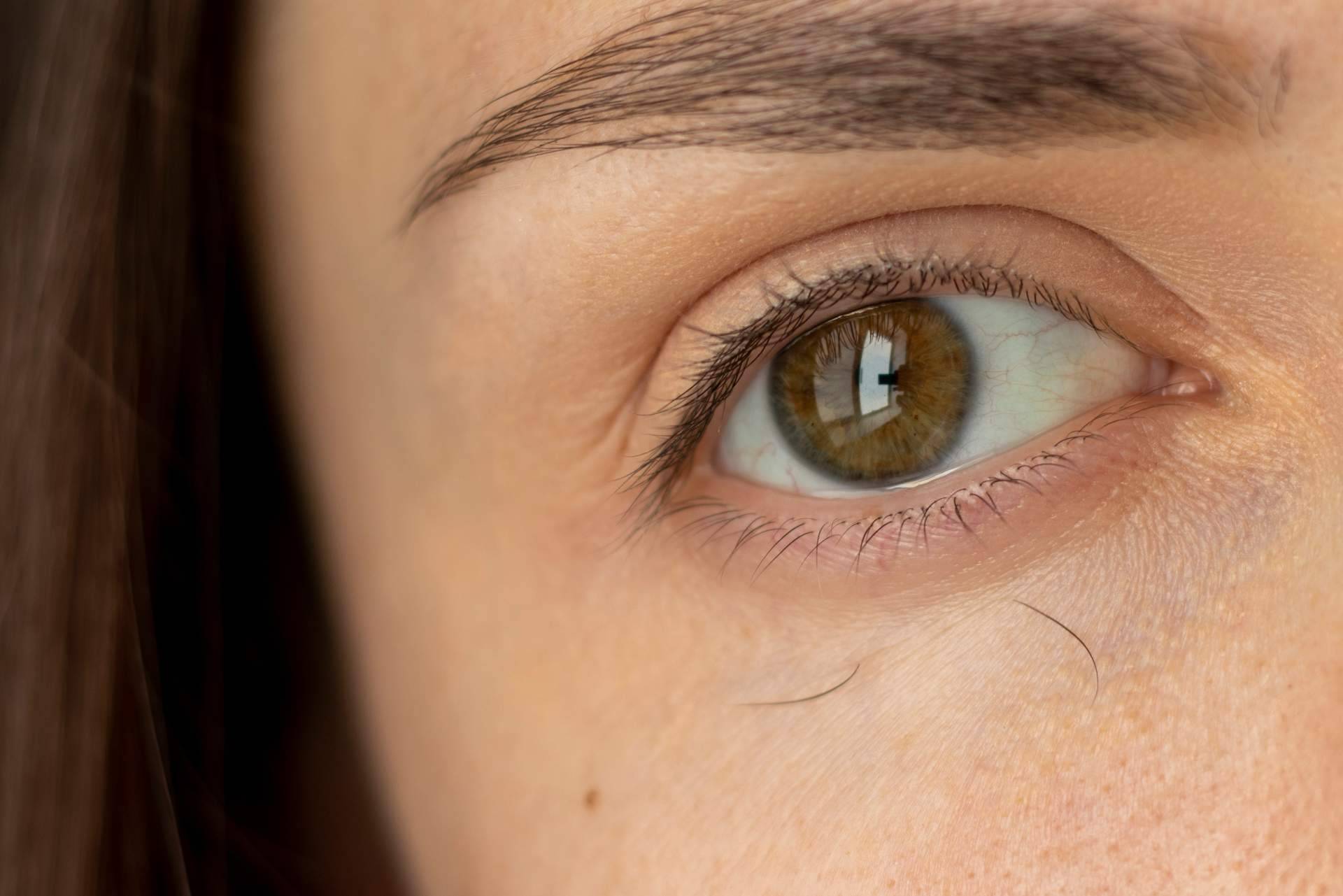 ¿Por qué se cae el pelo de las cejas? El Doctor Jesús Mora y Capilar Innovation Clinic lo explican