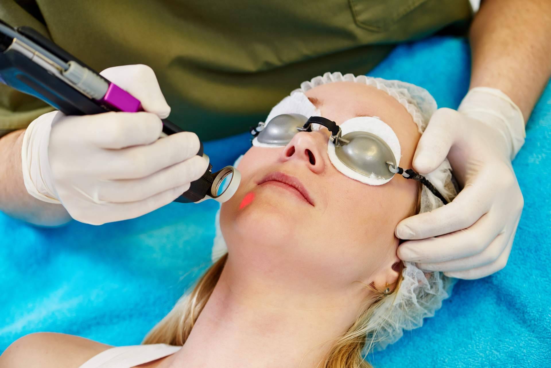 Eliminación de manchas en la piel con el láser Q Switched Nd Yag del Centro Médico El Pilar