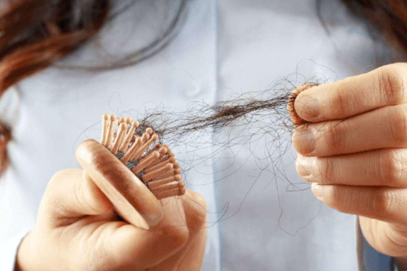 ¿Se cae el pelo por estrés?