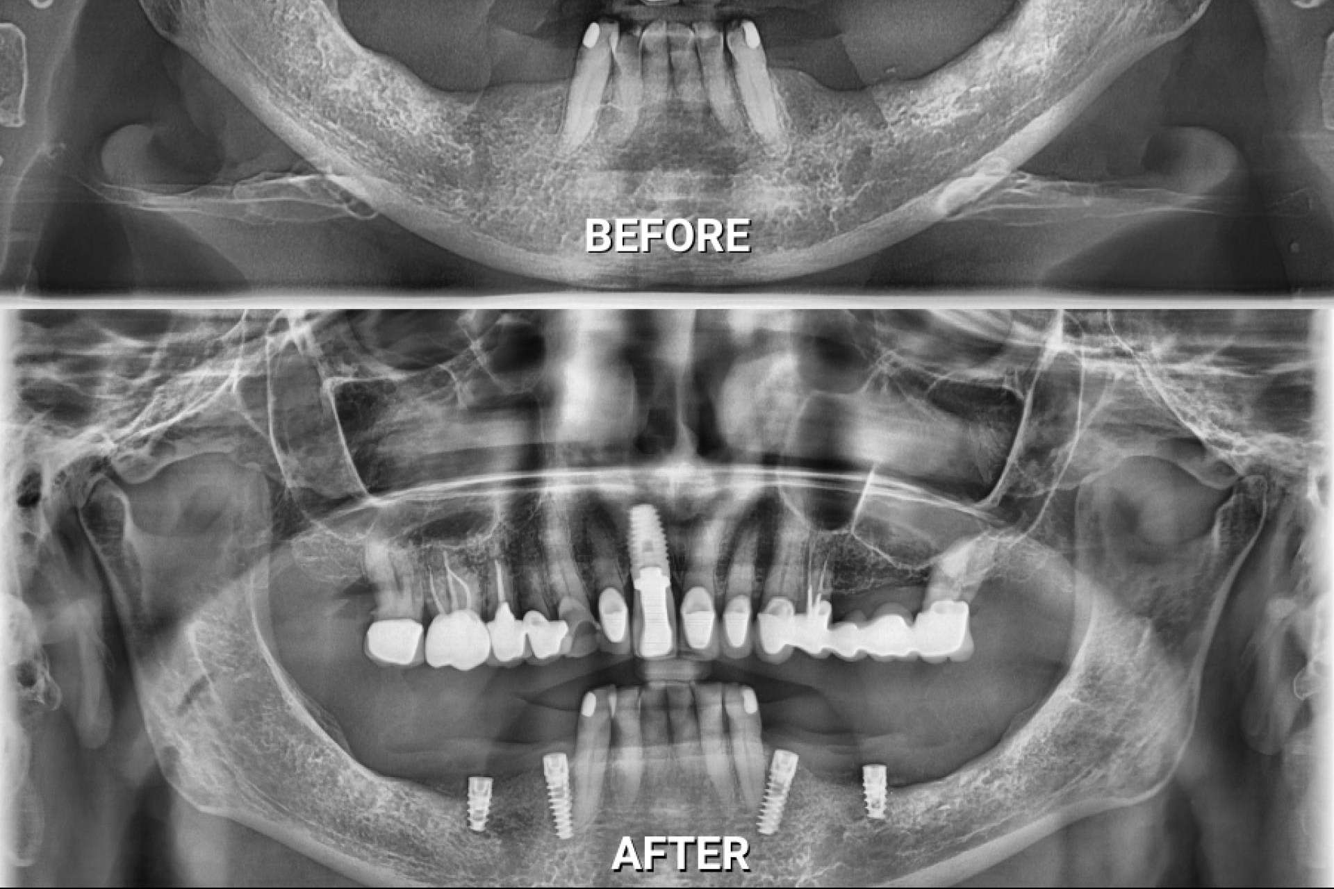La tendencia en aumento hacia la odontología integral, biológica y regenerativa en Puerto Vallarta, México