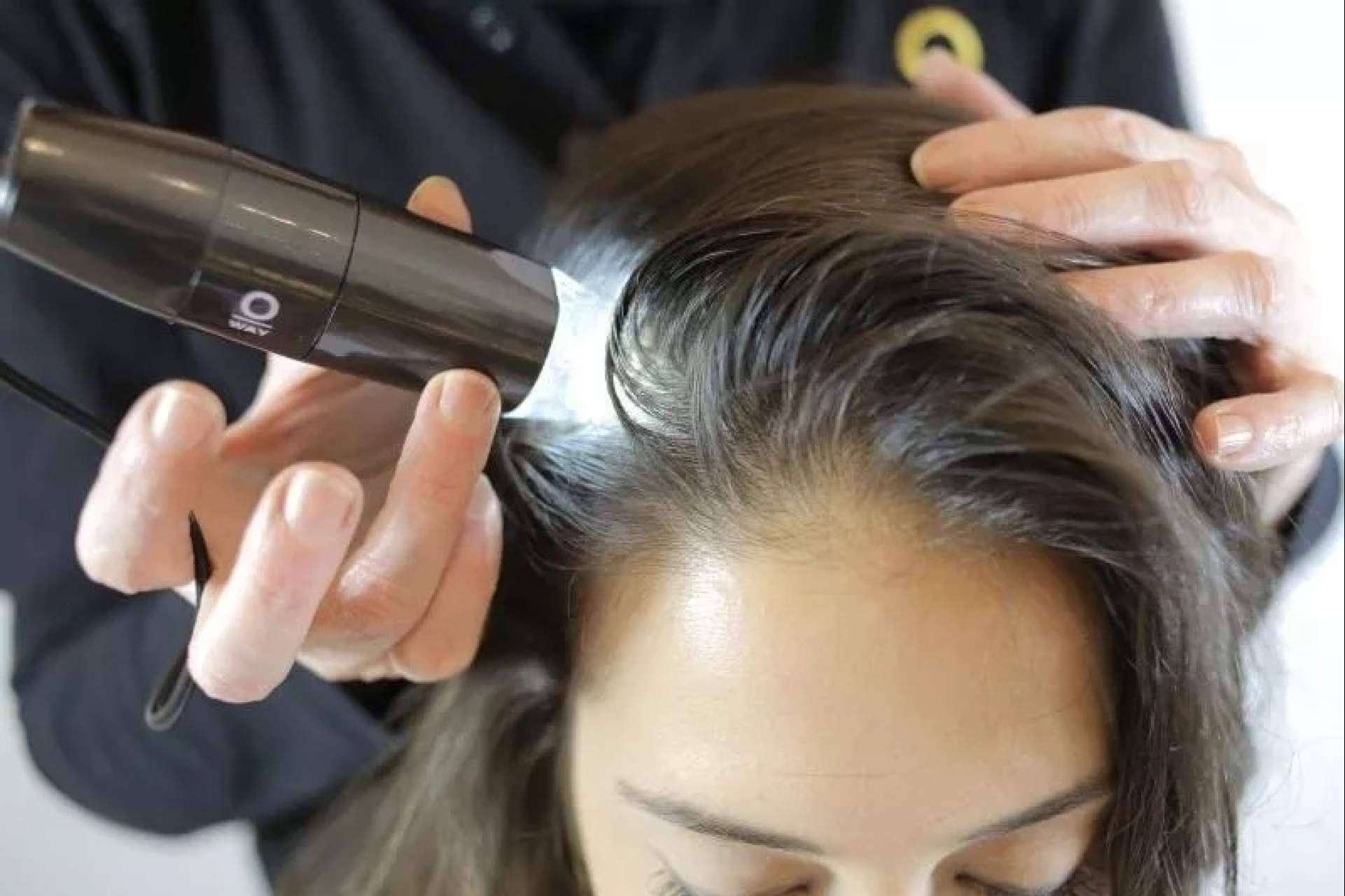IMD cuenta con más de 20 años poniendo solución a la alopecia areata