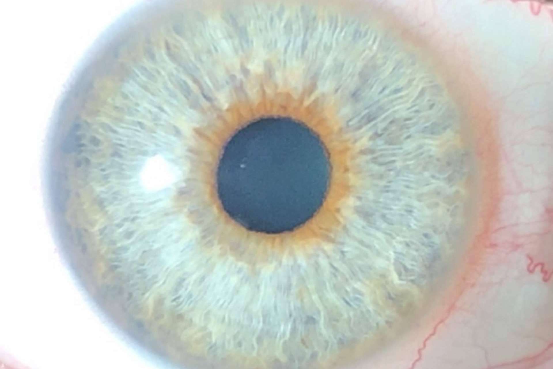 Distribución del color de ojos, con Eyecos