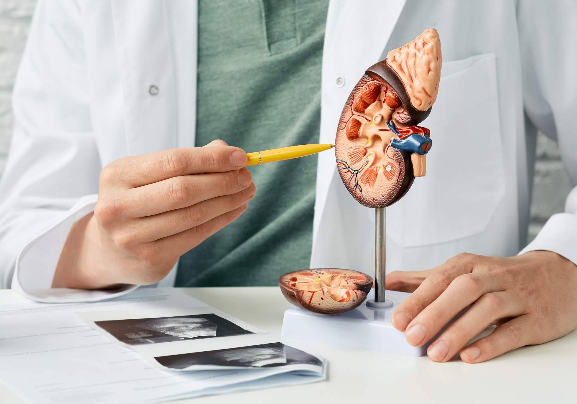 Cáncer de riñón. Causas, diagnóstico y tratamiento, por el Dr. Nelson Díez