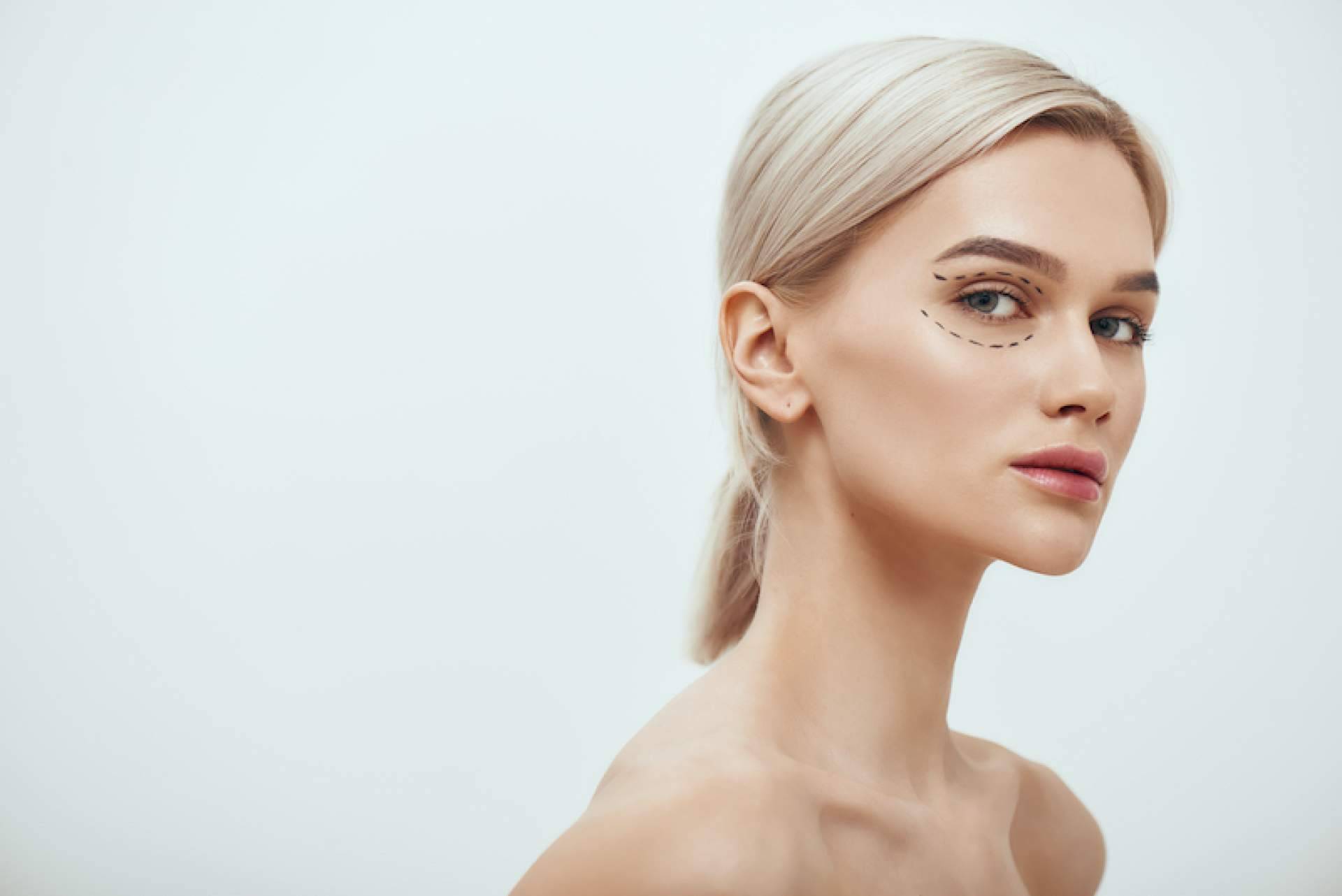 Blefaroplastia no quirúrgica para el tratamiento de párpados superiores así como inferiores cuando existe piel redundante