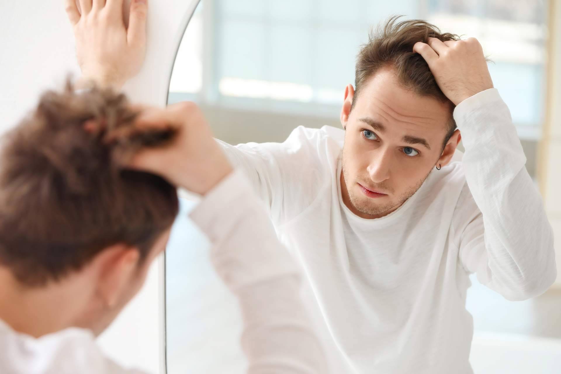Un tratamiento para combatir la alopecia, así es Xpecia hombre