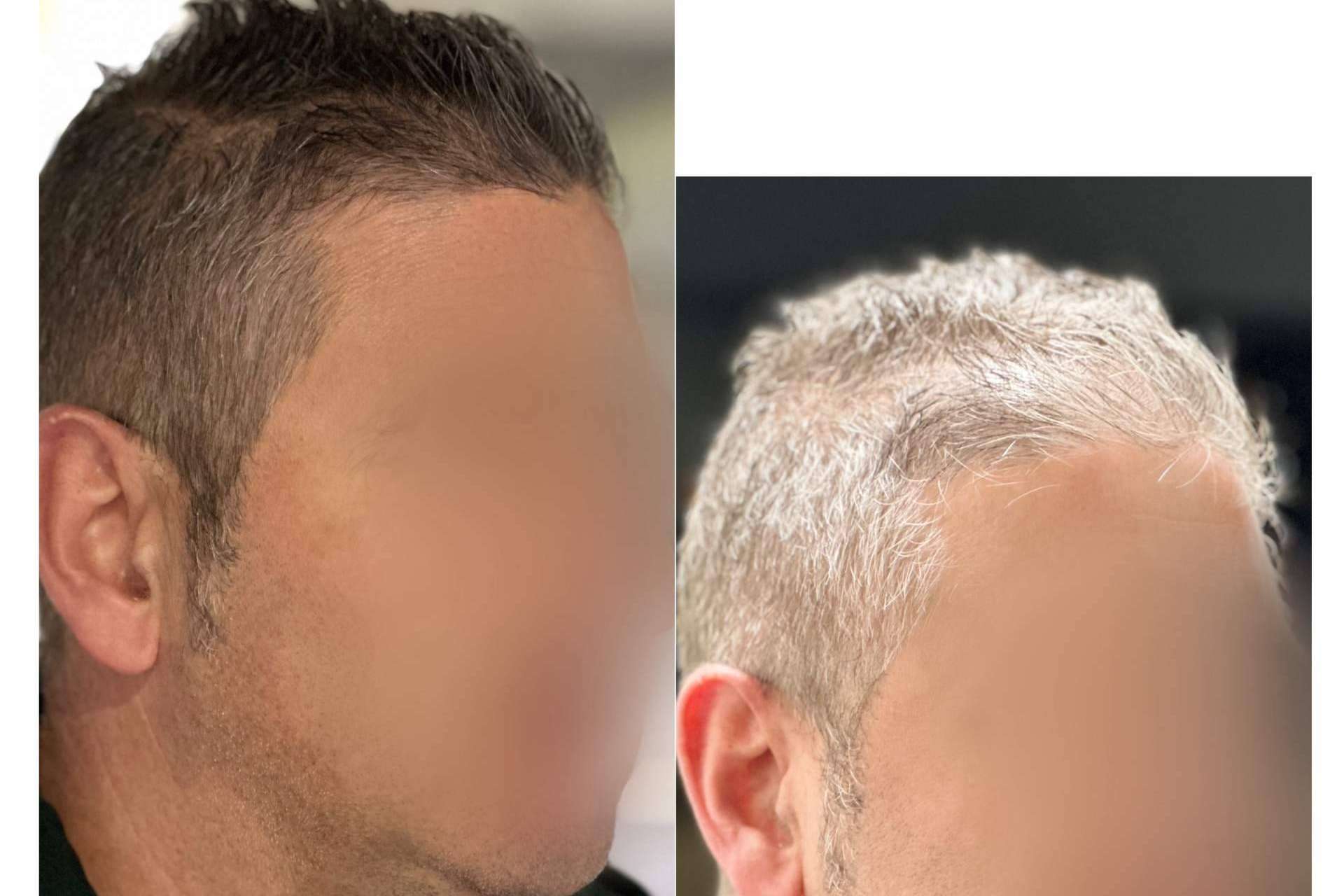 La Cera Negra Anti-Canas de Saw Palmetto que asegura fijación perfecta en el cuidado capilar masculino